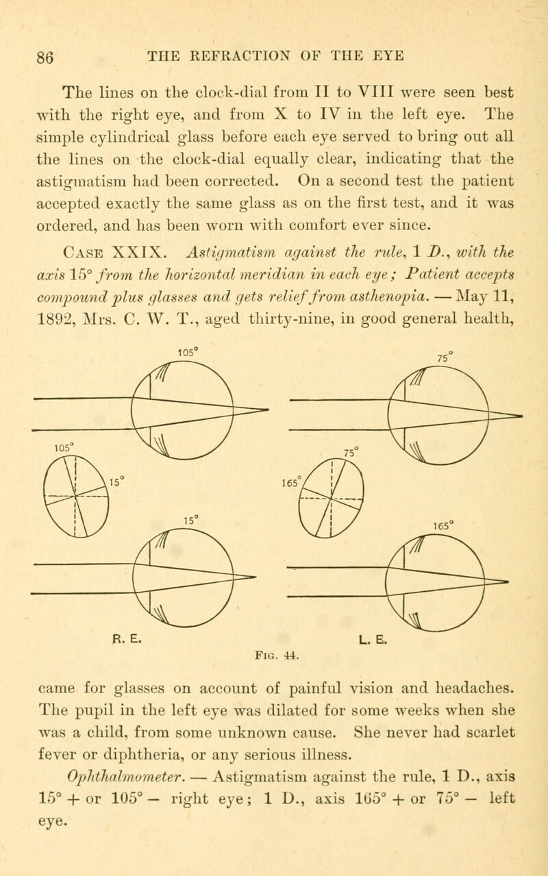 The lines on the clock-dial from II to VIII were seen best with the right eye, and from X to IV in the left eye. The simple cylindrical glass before each eye served to bring out all the lines on the clock-dial equally clear, indicating that the astigmatism had been corrected. On a second test the patient accepted exactly the same glass as on the first test, and it was ordered, and has been worn with comfort ever since. Case XXIX. Astigmatism against the rule, 1 D., with the axis 15° from the horizontal meridian in each eye; Patient accepts compound plus glasses and gets relief from asthenopia. — May 11, 1892, Mrs. C. W. T., aged thirty-nine, in good general health, R. E. L. B. came for glasses on account of painful vision and headaches. The pupil in the left eye was dilated for some weeks when she was a child, from some unknown cause. She never had scarlet fever or diphtheria, or any serious illness. Ophthalmometer. — Astigmatism against the rule, 1 D., axis 15°-(-or 105°- right eye; 1 D., axis ltlo0 + or 75°- left