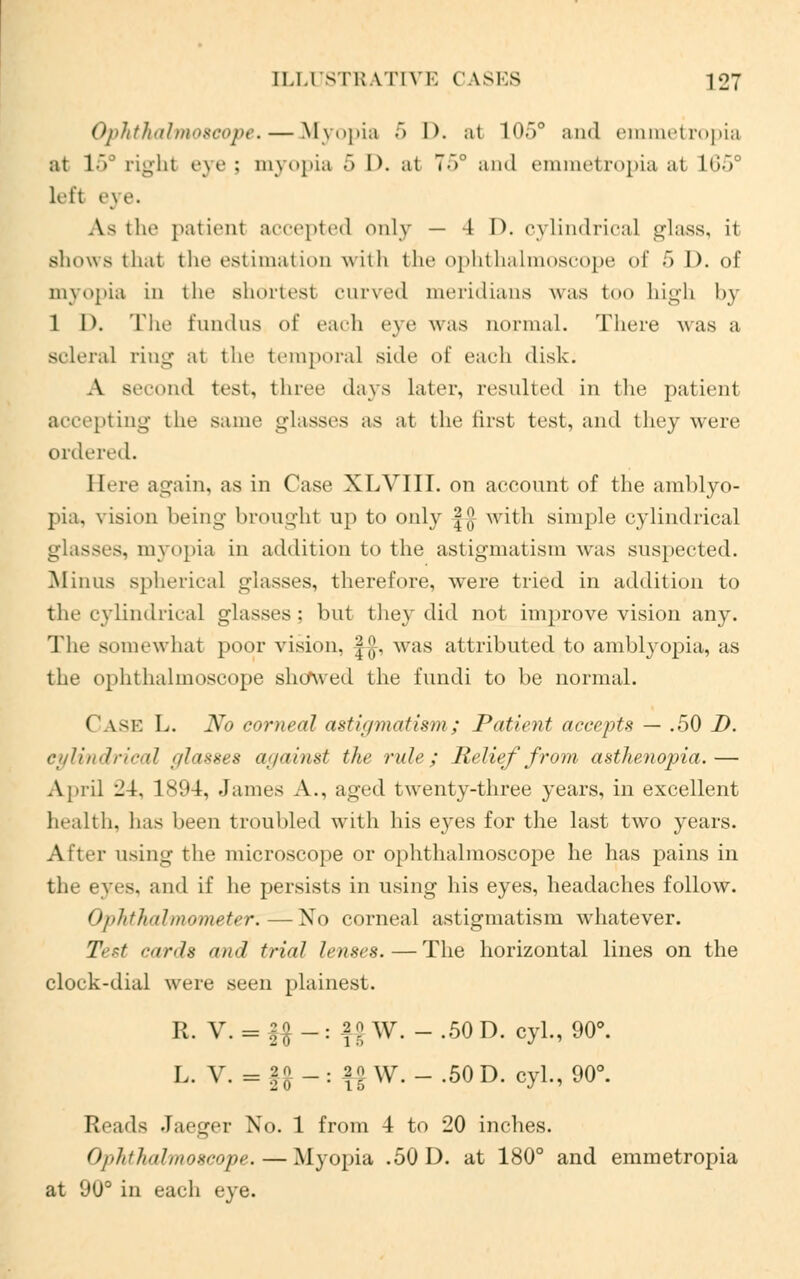 Ophthalmoscope. — Myopia 5 D. at 105° and emmetropia ;it 1 ~> right eye; myopia 5 I>. at 75° and emmetropia at l<i-Y left eye. A- the patient accepted only — 1 I), cylindrical glass, it shows that the estimation with the ophthalmoscope of 5 D. of myopia in the BhOrtest curved meridians was too high by 1 D. The fundus (»!' each eye was normal. There was a sclera] ring at the temporal side of each disk. A second test, three days later, resulted in the patient accepting the same glasses as at tlie first test, and they were ordered. Here again, as in Case XLVIII. on account of the amblyo- pia, vision being brought up to only |[J with simple cylindrical glasses, myopia in addition to the astigmatism was suspected. Minus spherical glasses, therefore, were tried in addition to the cylindrical glasses; but they did not improve vision any. The somewhat poor vision, f$, was attributed to amblyopia, as the ophthalmoscope showed the fundi to be normal. ( vse L. No corneal astigmatism; Patient accepts — .50 D. ciiUinlr'n-al !(Iasxt\s a>/ainst the rule; Relief from asthenopia.— April 24, 1894, James A., aged twenty-three years, in excellent health, has been troubled with his eyes for the last two years. After using the microscope or ophthalmoscope he has pains in the eyes, and if he persists in using his eyes, headaches follow. Ophthalmometer:—No corneal astigmatism whatever. Test cards and trial lenses.—The horizontal lines on the clock-dial were seen plainest. R. V. = |f -: )jj W. - .50 D. cyl., 90°. L. V. = U~- \l W. - .50 D. cyl., 90°. Reads Jaeger No. 1 from 4 to 20 inches. Ophthalmoscope. — Myopia .50 D. at 180° and emmetropia at 90° in each eye.