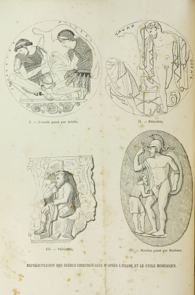 I. — l'utrocle pansé pur Achille II. — Philoctète. IV. — Ménélas pansé par MachaOD. REPRÉSENTATION DES SCÈNES CHIRURGICALES D'APliÈS L'ILIADE ET LE CYCLE HOMÉRIQUE.