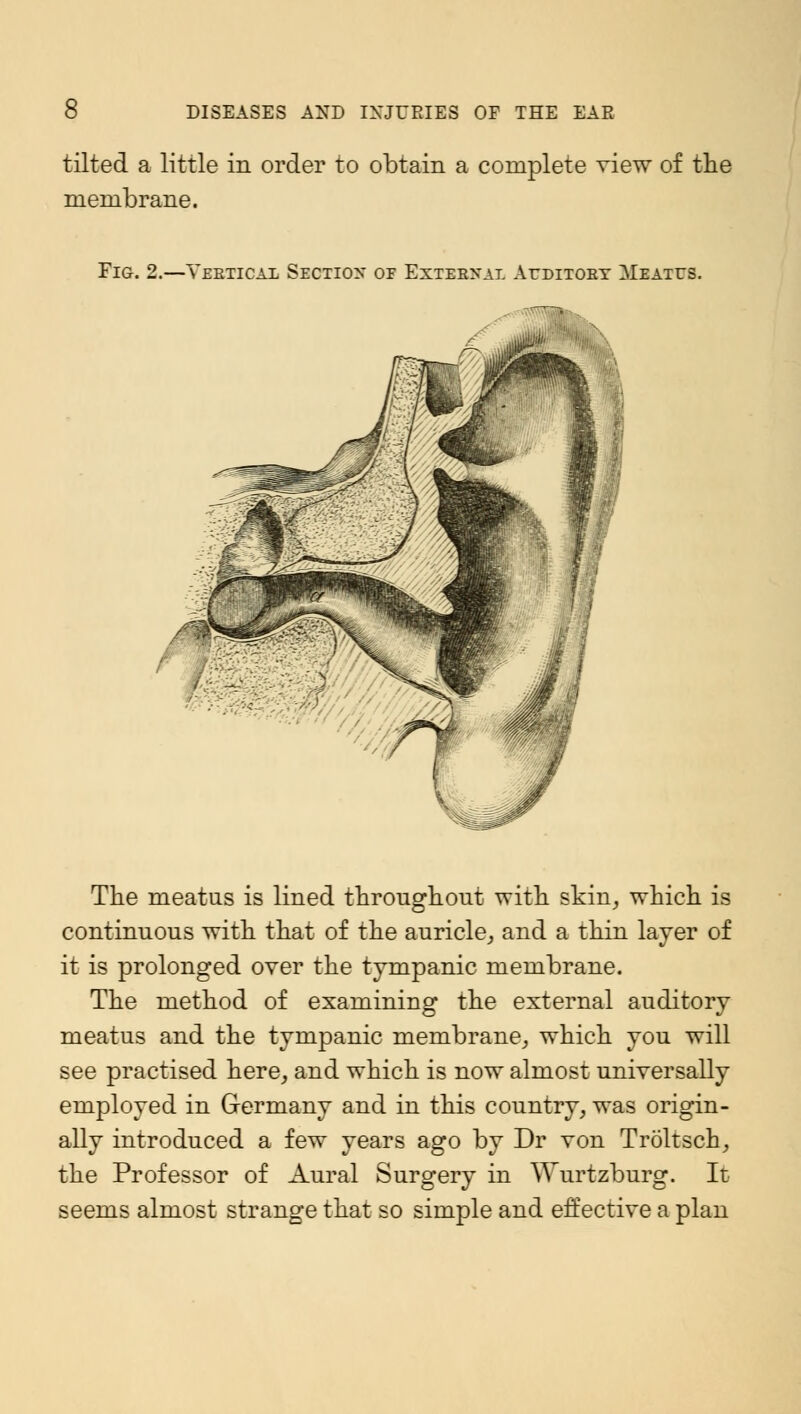 tilted a little in order to obtain a complete view of the membrane. Fig. 2.—Vertical Section or External Aeditoby Meatus. The meatus is lined throughout with skin, which is continuous with that of the auricle, and a thin layer of it is prolonged over the tympanic membrane. The method of examining the external auditory meatus and the tympanic membrane, which you will see practised here, and which is now almost universally employed in Germany and in this country, was origin- ally introduced a few years ago by Dr von Troltsch, the Professor of Aural Surgery in Wurtzburg. It seems almost strange that so simple and effective a plan