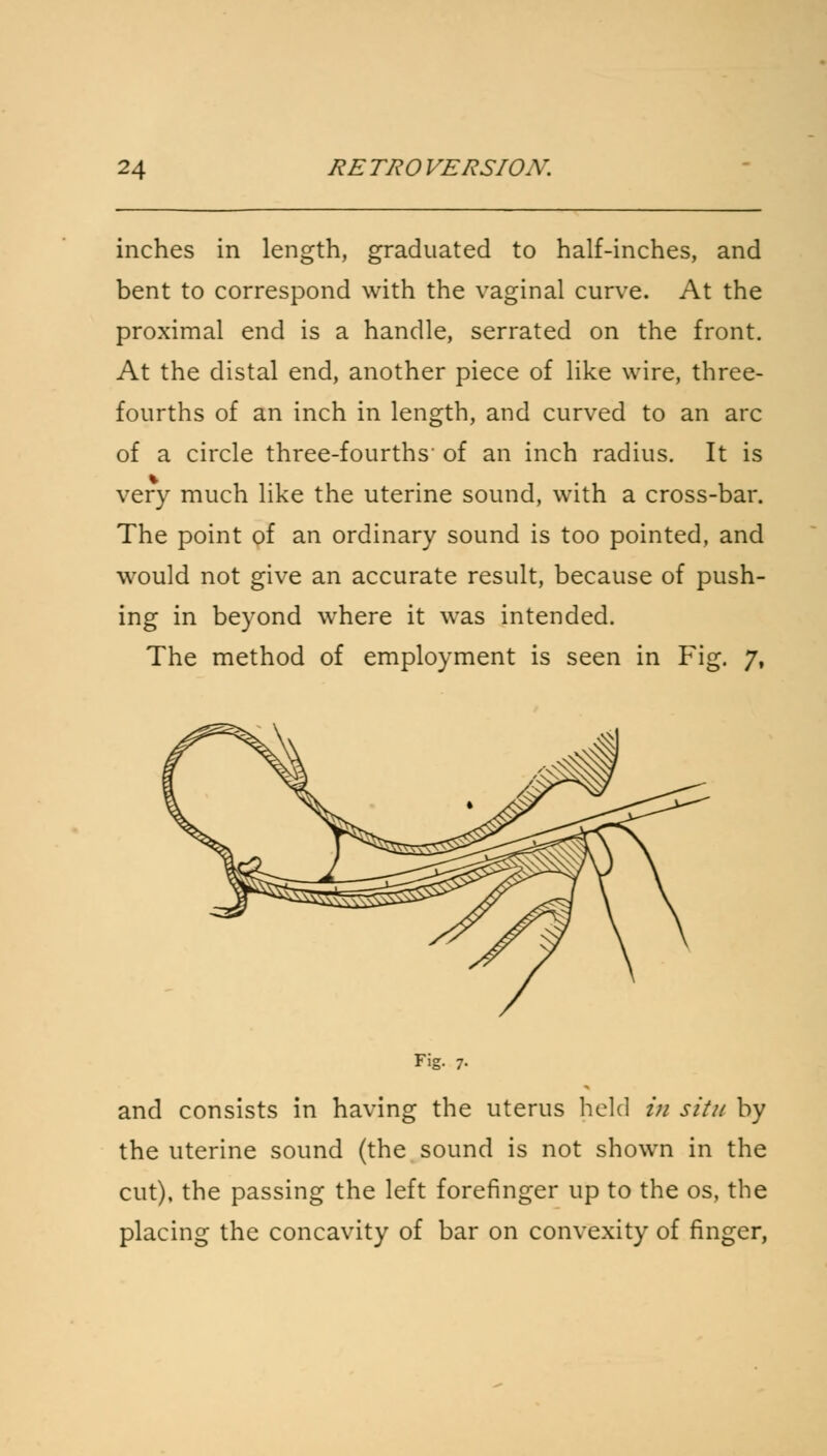inches in length, graduated to half-inches, and bent to correspond with the vaginal curve. At the proximal end is a handle, serrated on the front. At the distal end, another piece of like wire, three- fourths of an inch in length, and curved to an arc of a circle three-fourths' of an inch radius. It is very much like the uterine sound, with a cross-bar. The point of an ordinary sound is too pointed, and would not give an accurate result, because of push- ing in beyond where it was intended. The method of employment is seen in Fig. 7, and consists in having the uterus held in situ by the uterine sound (the sound is not shown in the cut), the passing the left forefinger up to the os, the placing the concavity of bar on convexity of finger,