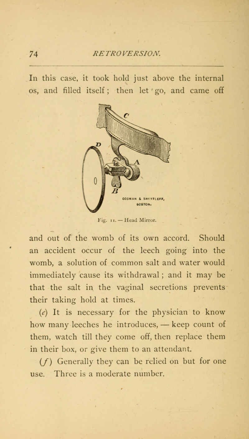 In this case, it took hold just above the internal os, and filled itself; then let ' go, and came off Fig. ii. — Head Minor. and out of the womb of its own accord. Should an accident occur of the leech going into the womb, a solution of common salt and water would immediately cause its withdrawal ; and it may be that the salt in the vaginal secretions prevents their taking hold at times. (e) It is necessary for the physician to know how many leeches he introduces, — keep count of them, watch till they come off, then replace them in their box, or give them to an attendant. (/) Generally they can be relied on but for one use. Three is a moderate number.