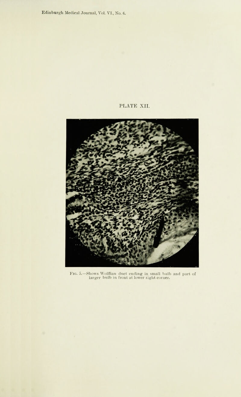 PLATE XII. -Shows Wolffi larger bu part, of