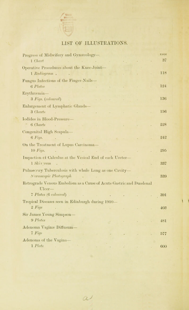 WTr: LIST OF ILLUSTRATIONS. I'AGR Progress of Midwifery and Gynaecology— 1 Chart . ... 37 Operative Procedures about the Knee-Joint— 1 Radiogram . . .118 Fungus Infections of the Finger-Nails— 6 Plates 124 Erythraemia — 3 Figs, (coloured) 136 Enlargement of Lymphatic Glands— 3 Cliarts 156 Iodides in Blood-Pressun— e.Charts . 228 Congenital High Scapula— 6 Figs. . . . 242 On the Treatment of Lupus < larcinoma— 10 Figs. . . 295 Impaction ct Calculus al the Vesical End of each CJreter— 1 Ski i in ru . . 337 Pulmoiliry Tuberculosis \\ i111 whole Lung as one Cavity— b'ereoscopic Photograph . 339 Retrograde Venous Embolism asa Cause of Acute Gastric and Duodenal Ulcer— 7 Plates 6 coloured) . . . 391 Tropical Diseases seen in Edinburgh during 1910— 2 Figs . 403 Sir James Young Simpson— 9 Plates . 481 Adenoma Vaginae Diffusum— 7 Figs . . 577 Adenoma of the Vagina— 1 Piatt . . 600