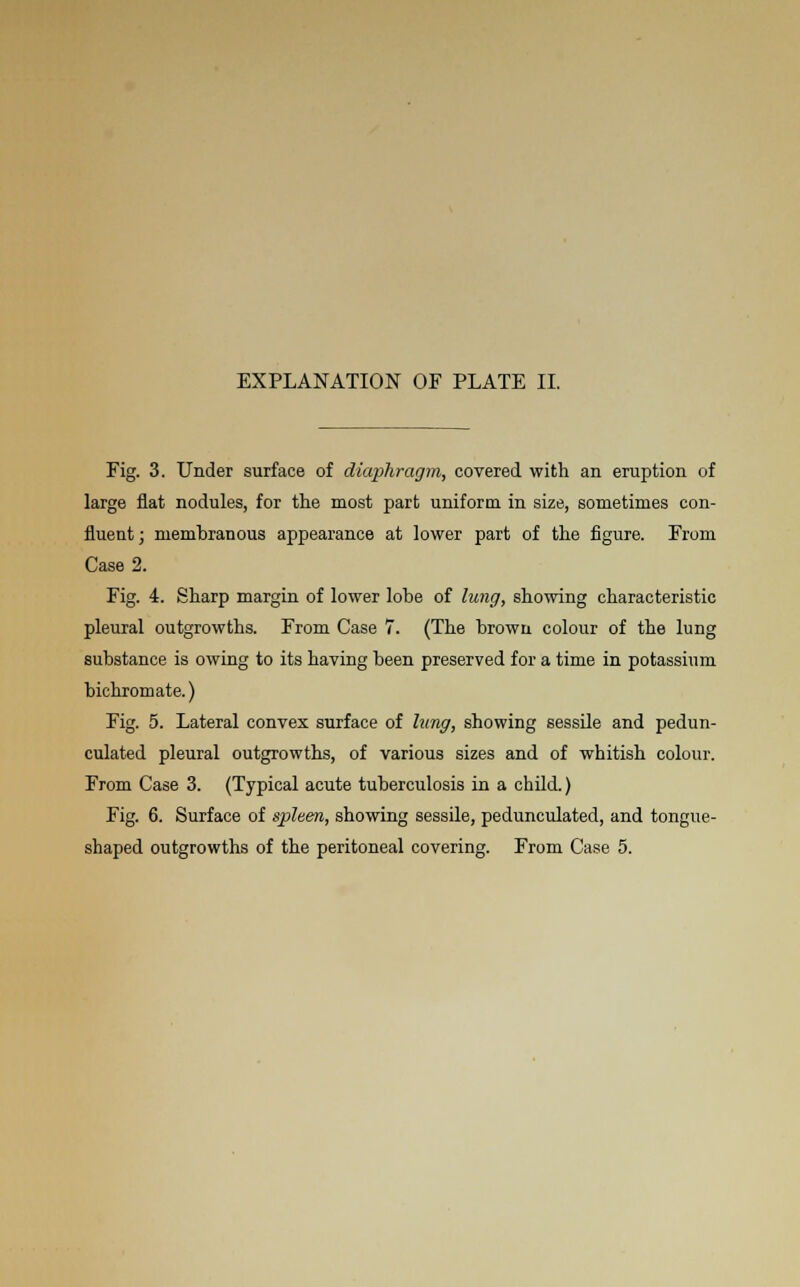 Fig. 3. Under surface of diaphragm, covered with an eruption of large flat nodules, for the most part uniform in size, sometimes con- fluent; membranous appearance at lower part of the figure. From Case 2. Fig. 4. Sharp margin of lower lobe of lung, showing characteristic pleural outgrowths. From Case 7. (The brown colour of the lung substance is owing to its having been preserved for a time in potassium bichromate.) Fig. 5. Lateral convex surface of lung, showing sessile and pedun- culated pleural outgrowths, of various sizes and of whitish colour. From Case 3. (Typical acute tuberculosis in a child.) Fig. 6. Surface of spleen, showing sessile, pedunculated, and tongue-