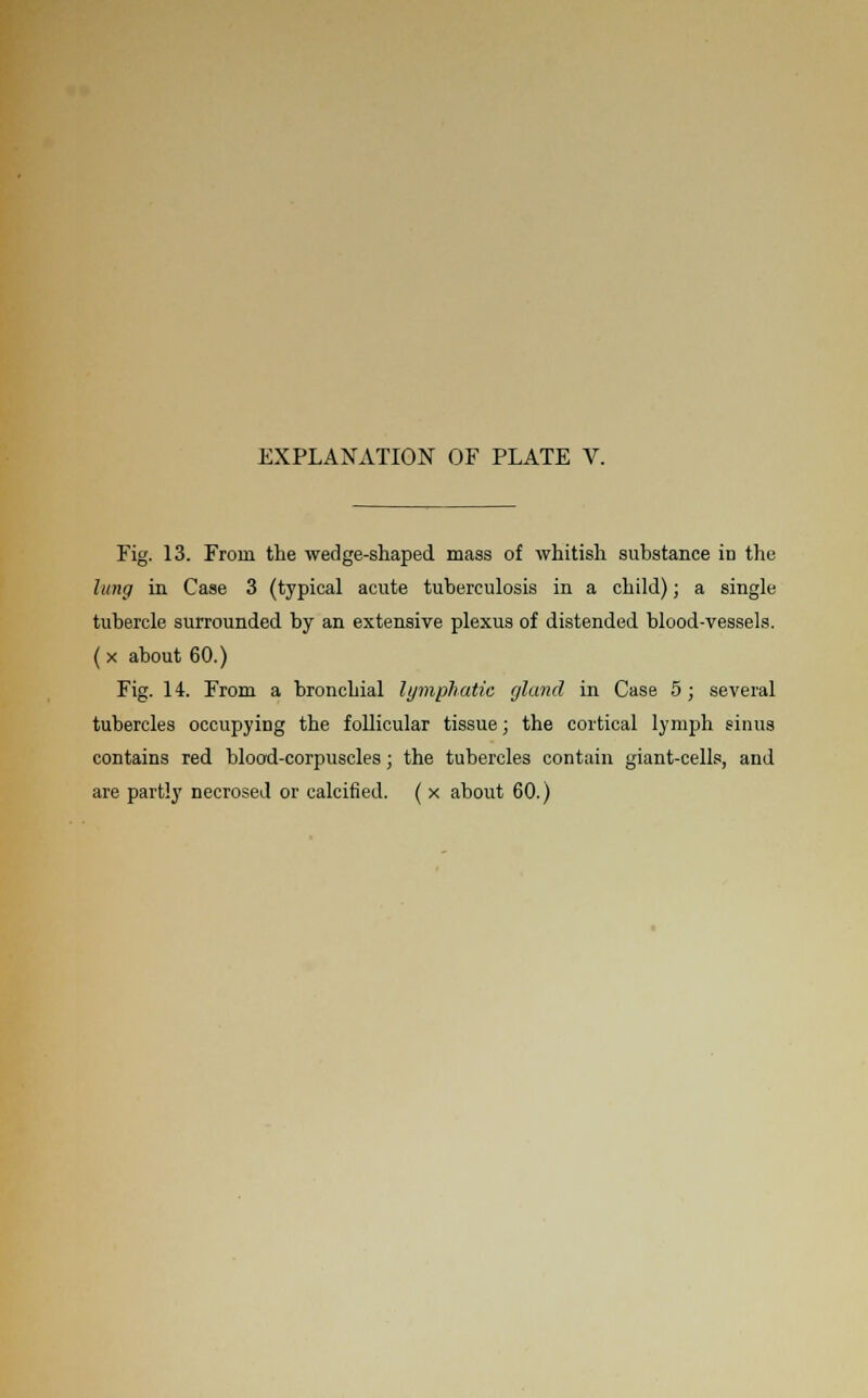 Fig. 13. From the wedge-shaped mass of whitish substance iD the lung in Case 3 (typical acute tuberculosis in a child); a single tubercle surrounded by an extensive plexus of distended blood-vessels. ( x about 60.) Fig. 14. From a bronchial lymphatic gland in Case 5; several tubercles occupying the follicular tissue; the cortical lymph sinus contains red blood-corpuscles; the tubercles contain giant-cells, and