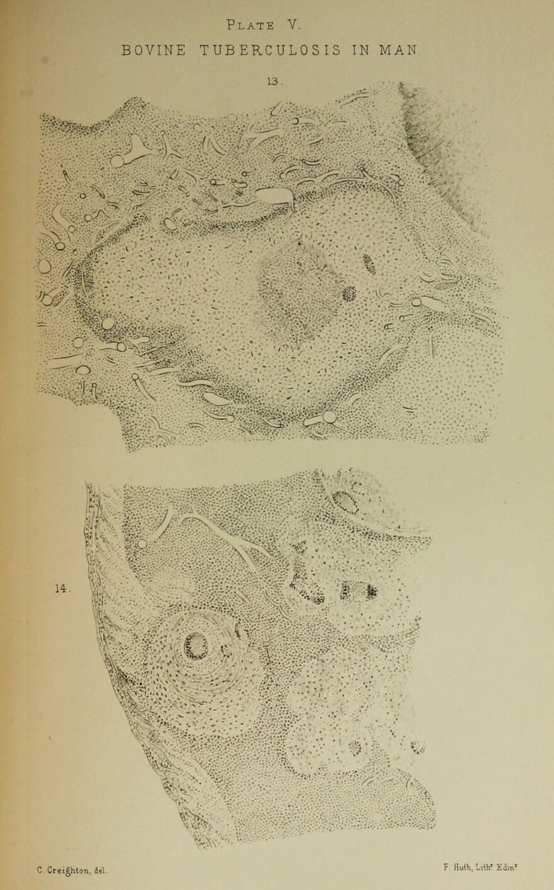 Plate V. BOVINE TUBERCULOSIS IN MAN 13. -1 —SW ■- ■  ' m ' ■ - ■ . • - - if . ^^•,.: ^'■'. l£' •.'•■fir.~ ••<^:v. —■ o 14. V . \ *&&:■:■ - '.■.-'.■'-C- ■- ' V LV ■ • I '. .... ; r- -■. I F Hutk, liW Elmr