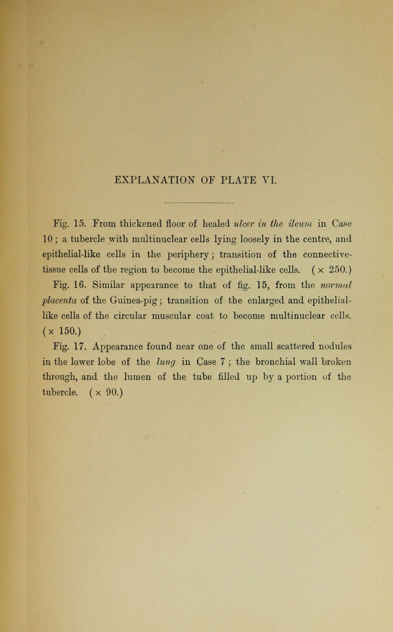 Fig. 15. From thickened floor of healed nicer in the ileum in Case 10; a tubercle with multinuclear cells lying loosely in the centre, and epithelial-like cells in the periphery; transition of the connective- tissue cells of the region to become the epithelial-like cells. ( x 250.) Fig. 16. Similar appearance to that of fig. 15, from the normal placenta of the Guinea-pig; transition of the enlarged and epithelial- like cells of the circular muscular coat to become multinuclear cells, (x 150.) Fig. 17. Appearance found near one of the small scattered nodules in the lower lobe of the lung in Case 7 ; the bronchial wall broken through, and the lumen of the tube filled up by a portion of the