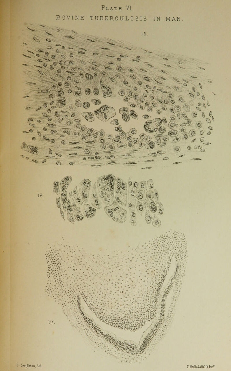 BOVINE TUBERCULOSIS IN MAN. 15. '%as ^ #■■•■<8 • «  3»S -tilth*, «l  sea «*• I s ©.: © <s? i^jss :5 0 O0 16 I1 | £ i hVi ft ^ . ;i ;.<? • n 17. I ! ■ ■ ,, ■ < ( ^■■-' ■, mm -? '• ■'•■; %& '^:.;r^/;i-:;::,:;i-.-V'....-.-i-.--,-.■;■•' '•• ■•.'•: ask- c**H^»*i;.°o^«- £§F.;  ^'4 # ; St-.