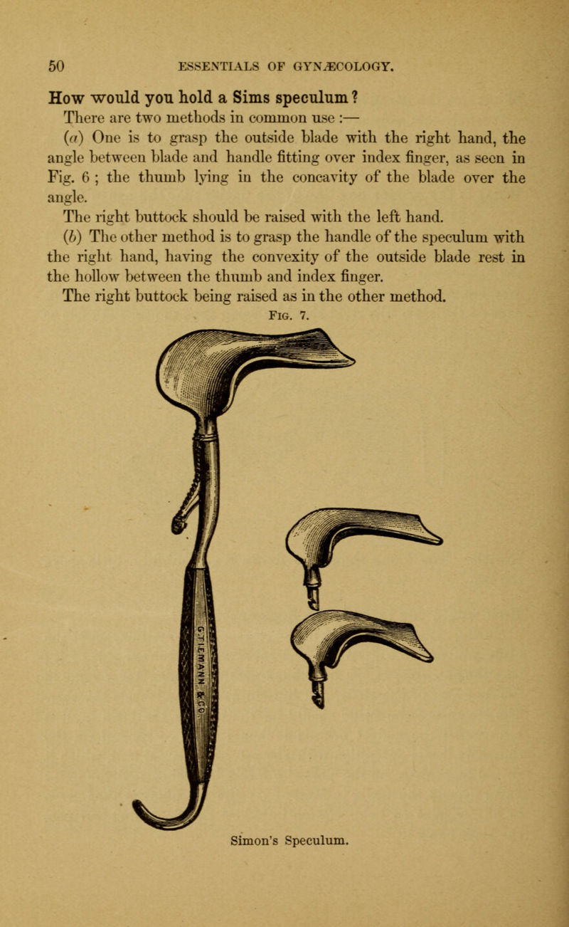 How would you hold a Sims speculum ? There are two methods in common use :— ((t) One is to grasp the outside blade with the right hand, the angle between blade and handle fitting over index finger, as seen in Fig. 6 ; the thumb lying in the concavity of the blade over the angle. The right buttock should be raised with the left hand. (b) The other method is to grasp the handle of the speculum with the right hand, having the convexity of the outside blade rest in the hollow between the thumb and index finger. The right buttock being raised as in the other method. Fig. 7. Simon's Speculum.