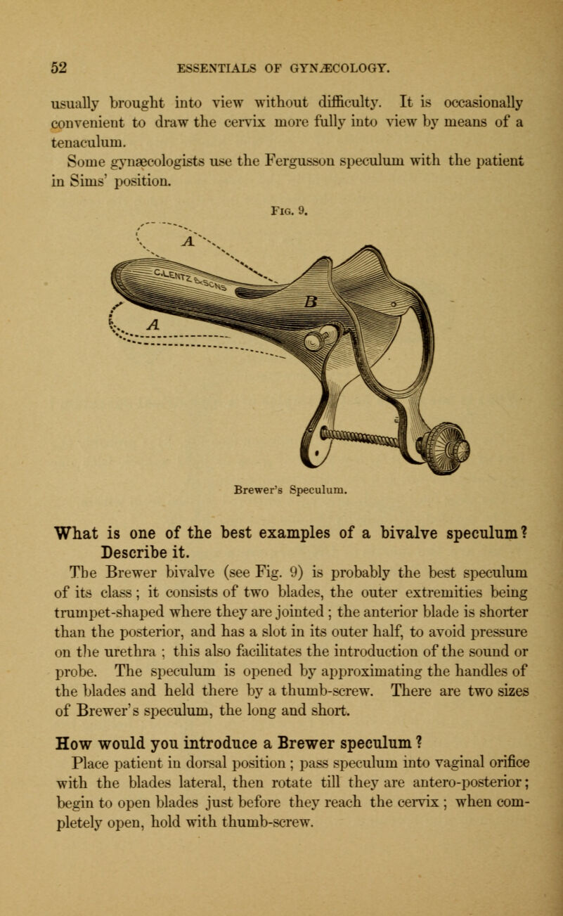 usually brought into view without difficulty. It is occasionally convenient to draw the cervix more fully into view by means of a tenaculum. Some gynaecologists use the Fergusson speculum with the patient in Sims' position. Fig. 9. Brewer's Speculum. What is one of the best examples of a bivalve speculum ? Describe it. The Brewer bivalve (see Fig. 9) is probably the best speculum of its class; it consists of two blades, the outer extremities being trumpet-shaped where they are jointed ; the anterior blade is shorter than the posterior, and has a slot in its outer half, to avoid pressure on the urethra : this also facilitates the introduction of the sound or probe. The speculum is opened by approximating the handles of the blades and held there by a thumb-screw. There are two sizes of Brewer's speculum, the long and short. How would you introduce a Brewer speculum ? Place patient in dorsal position ; pass speculum into vaginal orifice with the blades lateral, then rotate till they are antero-posterior; begin to open blades just before they reach the cervix ; when com- pletely open, hold with thumb-screw.