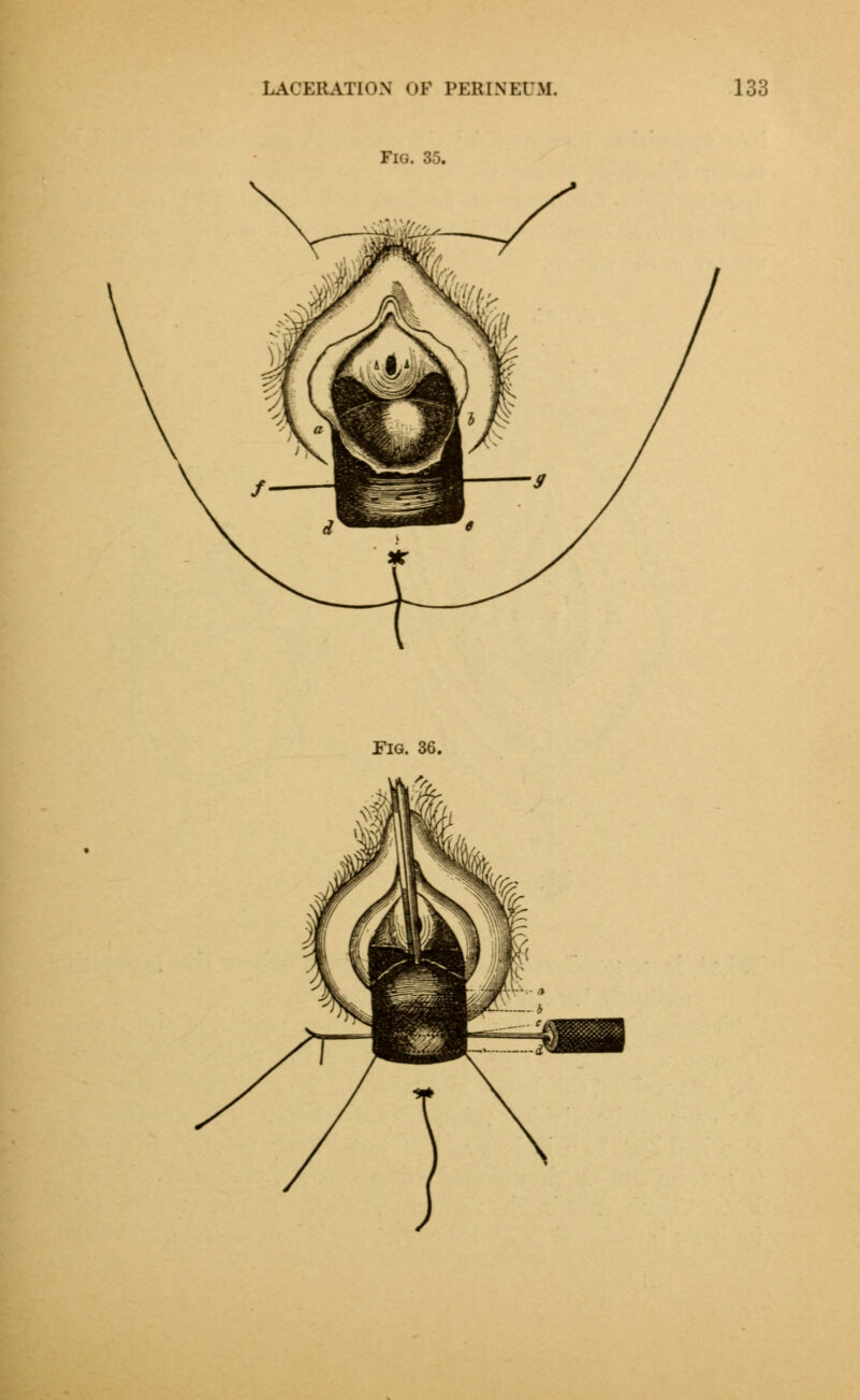 Fig. 35. Pig. 36.