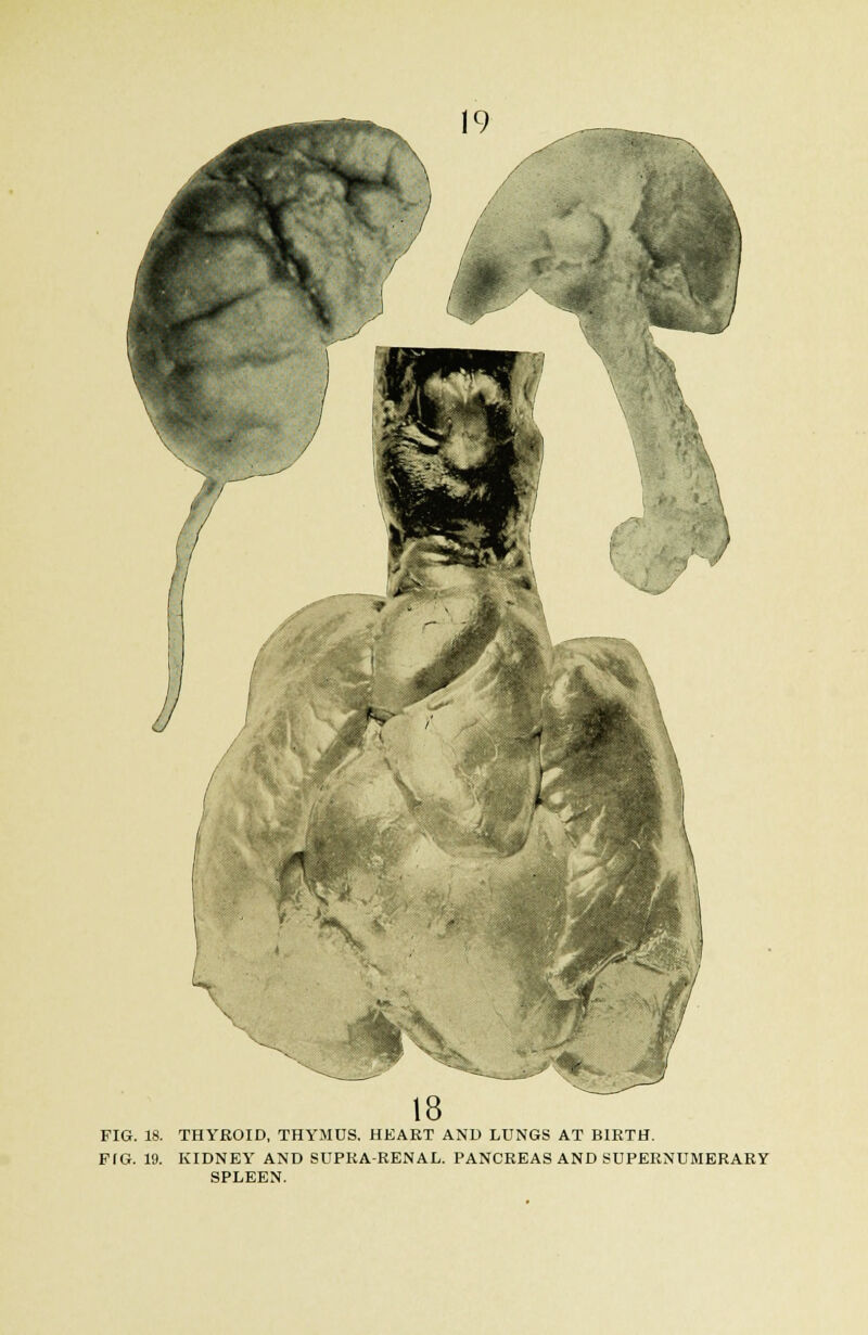 FIG. 18. THYROID, THYMUS. HEART AND LUNGS AT BIRTH. F(G. 19. KIDNEY AND SUPRARENAL. PANCREAS AND SUPERNUMERARY SPLEEN.