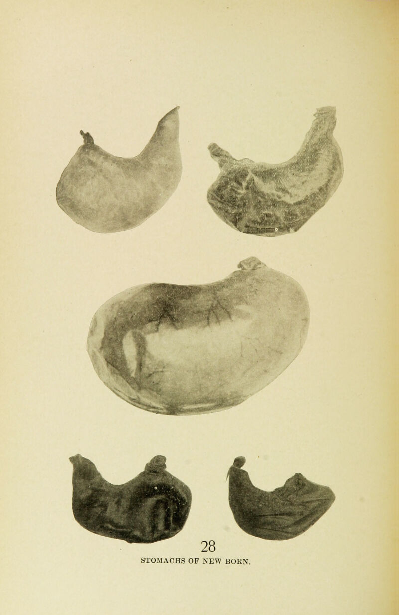 % 28 STOMACHS OF NEW BORN.