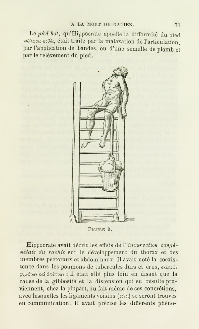 Le pied bot, qu'Hippocrate appelle la difformité du pied xûuwoi; wo*o'î, était traité par la malaxation de l'articulation, par l'application de bandes, ou d'une semelle de plomb et par le relèvement du pied. Figure 9. Hippocrate avait décrit les effets de l incurvation congé- nitale du rachis sur le développement du thorax et des membres pectoraux et abdominaux. Il avait noté la coexis- tence dans les poumons de tubercules durs et crus, uxXYipwv (pu^âruv x.a\ cuvsVrwv : il était allé plus loin en disant que la cause de la gihbosité et la distension qui en résulte pro- viennent, chez la plupart, du fait même de ces concrétious, avec lesquelles les ligaments voisins (tovoi) se seront trouvés eu communication. Il avait précisé les différents phéno-