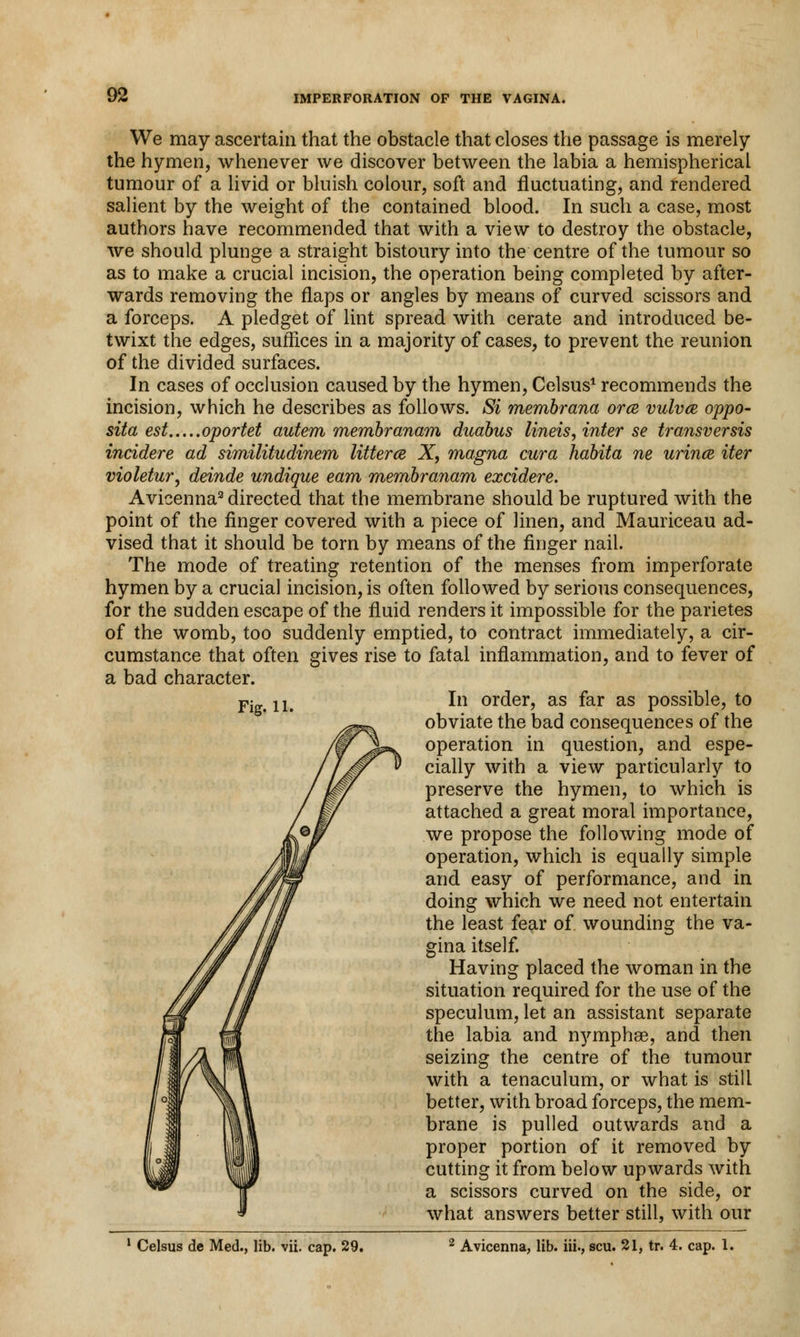 We may ascertain that the obstacle that closes the passage is merely the hymen, whenever we discover between the labia a hemispherical tumour of a livid or bluish colour, soft and fluctuating, and rendered salient by the weight of the contained blood. In such a case, most authors have recommended that with a view to destroy the obstacle, we should plunge a straight bistoury into the centre of the tumour so as to make a crucial incision, the operation being completed by after- wards removing the flaps or angles by means of curved scissors and a forceps. A pledget of lint spread with cerate and introduced be- twixt the edges, suffices in a majority of cases, to prevent the reunion of the divided surfaces. In cases of occlusion caused by the hymen, Celsus1 recommends the incision, which he describes as follows. Si membrana orce vulva, oppo- site/, est oportet autem membranam duabus lineis, inter se transversis incidere ad similitudinem litterce X, magna cura habita ne urince iter violetur, deinde undique earn membranam excidere. Avicenna3 directed that the membrane should be ruptured with the point of the finger covered with a piece of linen, and Mauriceau ad- vised that it should be torn by means of the finger nail. The mode of treating retention of the menses from imperforate hymen by a crucial incision, is often followed by serious consequences, for the sudden escape of the fluid renders it impossible for the parietes of the womb, too suddenly emptied, to contract immediately, a cir- cumstance that often gives rise to fatal inflammation, and to fever of a bad character. Fig 1L In order, as far as possible, to obviate the bad consequences of the operation in question, and espe- cially with a view particularly to preserve the hymen, to which is attached a great moral importance, we propose the following mode of operation, which is equally simple and easy of performance, and in doing which we need not entertain the least fear of wounding the va- gina itself. Having placed the woman in the situation required for the use of the speculum, let an assistant separate the labia and nymphse, and then seizing the centre of the tumour with a tenaculum, or what is still better, with broad forceps, the mem- brane is pulled outwards and a proper portion of it removed by cutting it from below upwards with a scissors curved on the side, or what answers better still, with our 1 Celsus de Med., lib. vii. cap. 29. 2 Avicenna, lib. iii., scu. 21, tr. 4. cap. 1.
