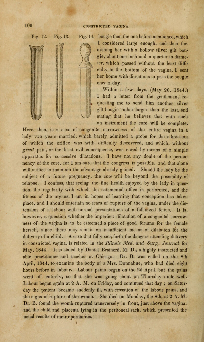 Fig. 12. Fig. 13. Fig. 14. bougie than the one before mentioned, which I considered large enough, and then fur- nishing her with a hollow silver gilt bou- gie, about one inch and a quarter in diame- ter, which passed without the least diffi- culty to the bottom of the vagina, I sent her home with directions to pass the bougie once a day. Within a few days, (May 20, 1844,) I had a letter from the gentleman, re- questing me to send him another silver gilt bougie rather larger than the last, and stating that he believes that with such an instrument the cure will be complete. Here, then, is a case of congenite narrowness of the entire vagina in a lady two years married, which barely admitted a probe for the admission of which the orifice was with difficulty discovered, and which, without great pain, or the least evil consequence, was cured by means of a simple apparatus for successive dilatations. I have not any doubt of the perma- nency of the cure, for I am sure that the congress is possible, and that alone will suffice to maintain the advantage already gained. Should the lady be the subject of a future pregnancy, the cure will be beyond the possibility of relapse. I confess, that seeing the fine health enjoyed by the lady in ques- tion, the regularity with which the catamenial office is performed, and the fitness of the organs, I am in hopes of learning that conception has taken place, and I should entertain no fears of rupture of the vagina, under the dis- tension of a labour with normal presentations of a full-sized foetus. It is, however, a question whether the imperfect dilatation of a congenital narrow- ness of the vagina is to be esteemed a piece of good fortune for the female herself, since there may remain an insufficient means of dilatation for the delivery of a child. A case that fully sets forth the dangers attending delivery in constricted vagina, is related in the Illinois Med. and Surg. Journal for May, 1844. It is stated by Daniel Brainerd, M. D., a highly instructed and able practitioner and teacher at Chicago. Dr. B. was called on the 8th April, 1844, to examine the body of a Mrs. Donnahue, who had died eight hours before in labour. Labour pains began on the 2d April, but the pains went off entirely, so that she was going about on Thursday quite well. Labour began again at 2 A. M. on Friday, and continued that day ; on Satur- day the patient became suddenly ill, with cessation of the labour pains, and the signs of rupture of the womb. She died on Monday, the 8th, at 2 A. M. Dr. B. found the womb ruptured transversely in front, just above the vagina, and the child and placenta lying in the peritoneal sack, which presented the usual results of metro-peritonitis.