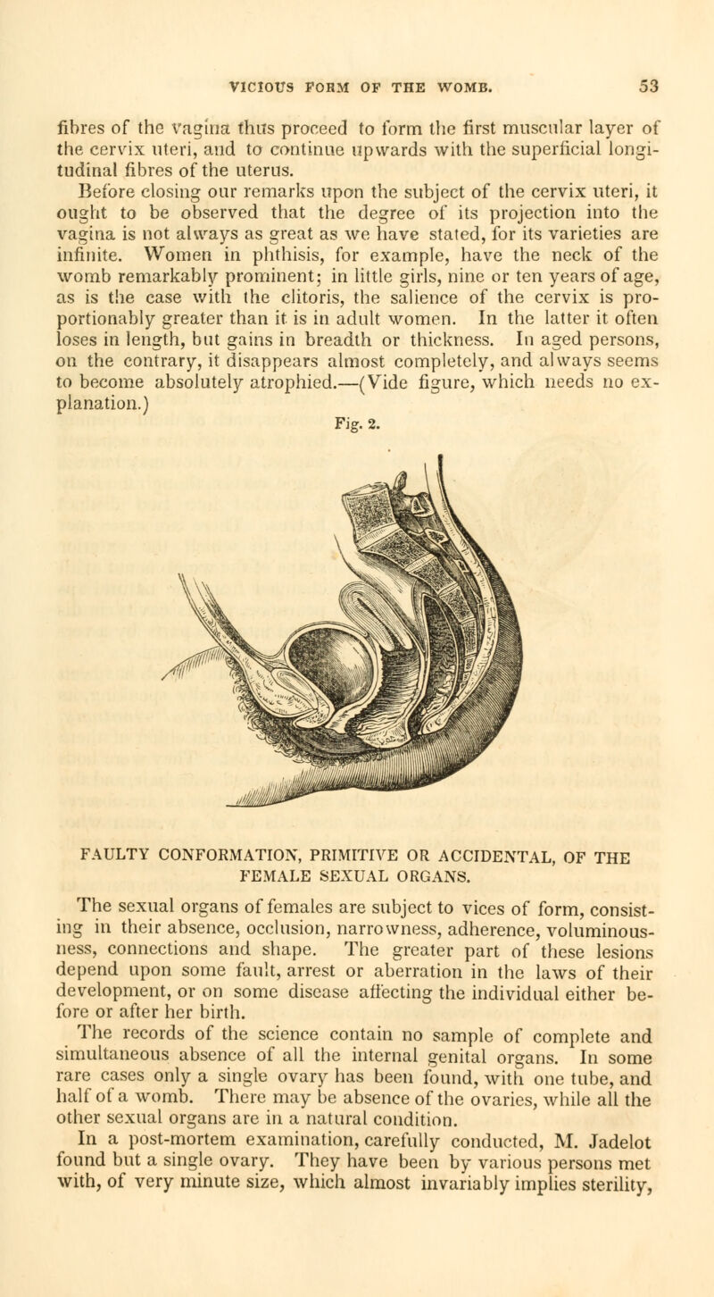 fibres of the vagina thus proceed to form the first muscular layer of the cervix uteri, and to continue upwards with the superficial longi- tudinal fibres of the uterus. Before closing our remarks upon the subject of the cervix uteri, it ought to be observed that the degree of its projection into the vagina is not always as great as we have stated, for its varieties are infinite. Women in phthisis, for example, have the neck of the womb remarkably prominent; in little girls, nine or ten years of age, as is the case with the clitoris, the salience of the cervix is pro- portionably greater than it is in adult women. In the latter it often loses in length, but gains in breadth or thickness. In aged persons, on the contrary, it disappears almost completely, and always seems to become absolutely atrophied.—(Vide figure, which needs no ex- planation.) Fig. 2. FAULTY CONFORMATION, PRIMITIVE OR ACCIDENTAL, OF THE FEMALE SEXUAL ORGANS. The sexual organs of females are subject to vices of form, consist- ing in their absence, occlusion, narrowness, adherence, voluminous- ness, connections and shape. The greater part of these lesions depend upon some fault, arrest or aberration in the laws of their development, or on some disease affecting the individual either be- fore or after her birth. The records of the science contain no sample of complete and simultaneous absence of all the internal genital organs. In some rare cases only a single ovary has been found, with one tube, and half of a womb. There may be absence of the ovaries, while all the other sexual organs are in a natural condition. In a post-mortem examination, carefully conducted, M. Jadelot found but a single ovary. They have been by various persons met with, of very minute size, which almost invariably implies sterility,