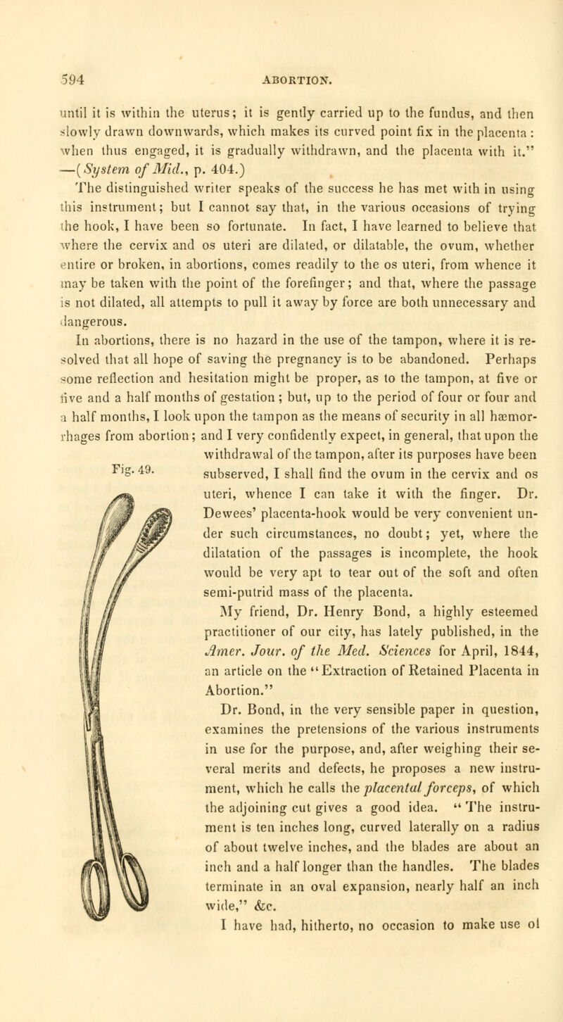 Fig. 49. until it is within the uterus; it is gently carried up to the fundus, and then slowly drawn downwards, which makes its curved point fix in the placenta : when thus engaged, it is gradually withdrawn, and the placenta with it. —{System of Mid., p. 404.) The distinguished writer speaks of the success he has met with in using this instrument; but I cannot say that, in the various occasions of trying ;he hook, I have been so fortunate. In fact, I have learned to believe that where the cervix and os uteri are dilated, or dilatable, the ovum, whether entire or broken, in abortions, comes readily to the os uteri, from whence it may be taken with the point of the forefinger; and that, where the passage is not dilated, all attempts to pull it away by force are both unnecessary and langerous. In abortions, there is no hazard in the use of the tampon, where it is re- solved that all hope of saving the pregnancy is to be abandoned. Perhaps ^ome reflection and hesitation might be proper, as to the tampon, at five or live and a half months of gestation ; but, up to the period of four or four and a half months, I look upon the tampon as the means of security in all hemor- rhages from abortion ; and I very confidently expect, in general, that upon the withdrawal of the tampon, after its purposes have been subserved, I shall find the ovum in the cervix and os uteri, whence I can take it with the finger. Dr. Dewees' placenta-hook would be very convenient un- der such circumstances, no doubt ; yet, where the dilatation of the passages is incomplete, the hook would be very apt to tear out of the soft and often semi-putrid mass of the placenta. My friend, Dr. Henry Bond, a highly esteemed practitioner of our city, has lately published, in the Amer. Jour, of the Med. Sciences for April, 1844, an article on the Extraction of Retained Placenta in Abortion. Dr. Bond, in the very sensible paper in question, examines the pretensions of the various instruments in use for the purpose, and, after weighing their se- veral merits and defects, he proposes a new instru- ment, which he calls the placental, forceps, of which the adjoining cut gives a good idea.  The instru- ment is ten inches long, curved laterally on a radius of about twelve inches, and the blades are about an inch and a half longer than the handles. The blades terminate in an oval expansion, nearly half an inch wide, &c. I have had, hitherto, no occasion to make use ol