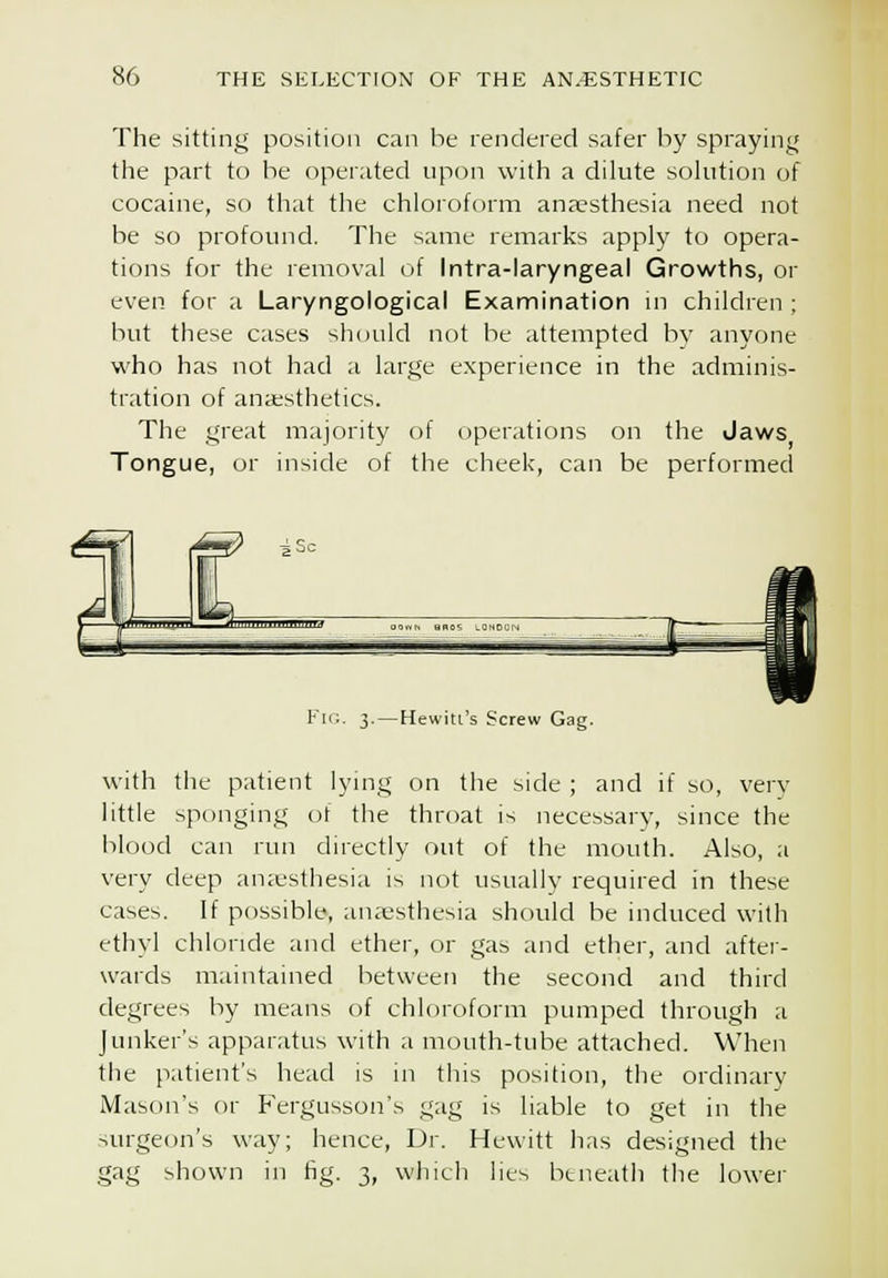 The sitting position can be rendered safer by spraying the part to be operated upon with a dilute sohition of cocaine, so that the chloroform anaesthesia need not be so profound. The same remarks apply to opera- tions for the removal of Intra-laryngeal Growths, or even for a Laryngological Examination in children ; but these cases should not be attempted bv anyone who has not had a large experience in the adminis- tration of anajsthetics. The great majority of operations on the Jaws Tongue, or inside of the cheek, can be performed ¥ni. 3.—Hewiti's Screw Gag. with the patient lymg on the side ; and if so, very little sponging of the throat is necessary, since the blood can run directly out of the mouth. Also, a very deep anaesthesia is not usually required in these cases. If possible, anaesthesia should be induced with ethyl chloride and ether, or gas and ether, and after- wards maintained between the second and third degrees by means of chloroform pumped through a Junker's apparatus with a mouth-tube attached. When the patient's head is in this position, the ordinary Mason's or Fergusson's gag is liable to get in the surgeon's way; hence, Dr. Hewitt has designed the gag shown in fig. 3, which lies beneath tlie lower