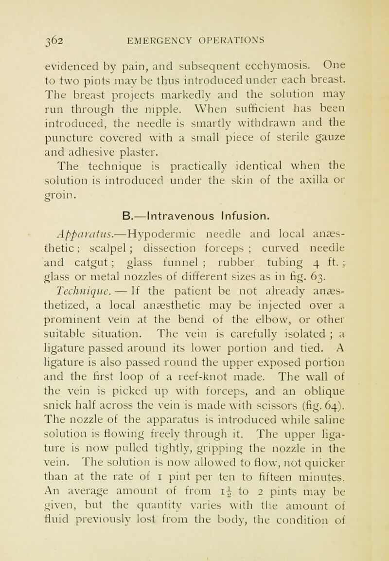 evidenced by pain, and subsequent eccliymosis. One to two pints may be thus introduced under each breast. Tlie breast projects markedly and the sokition may run through the nipple. When sufficient has been introduced, the needle is smartly withdrawn and the puncture covered with a small piece of sterile gauze and adhesive plaster. The technique is practically identical when the solution is introduced under the skin of the axilla or B.—Intravenous Infusion. Appiirntiis.—H3'podermic needle and local anaes- thetic ; scalpel ; dissection forceps ; curved needle and catgut ; glass funnel ; rubber tubing 4 ft. ; glass or metal nozzles of different sizes as in fig. 63. Tccliiiiquc. — If the patient be not already anaes- thetized, a local anaisthetic may be injected over a prominent vein at the bend of the elbow, or other suitable situation. The vein is carefully isolated ; a ligature passed around its lower portion and tied. A ligature is also passed round the upper exposed portion and the first loop of a reef-knot made. The wall of the vein is picked up with forceps, and an oblique snick half across the vein is made with scissors (fig. 64). The nozzle of the apparatus is introduced while saline solution is flowing freely through it. The upper liga- ture is now pulled tightly, gripping the nozzle in the vein. The solution is now allowed to flow, not quicker than at the rate of i pint per ten to fifteen minutes. An average amount of from i^ to 2 pints may be given, but the quantity varies with the amount of fluid previously lost from the body, the condition of