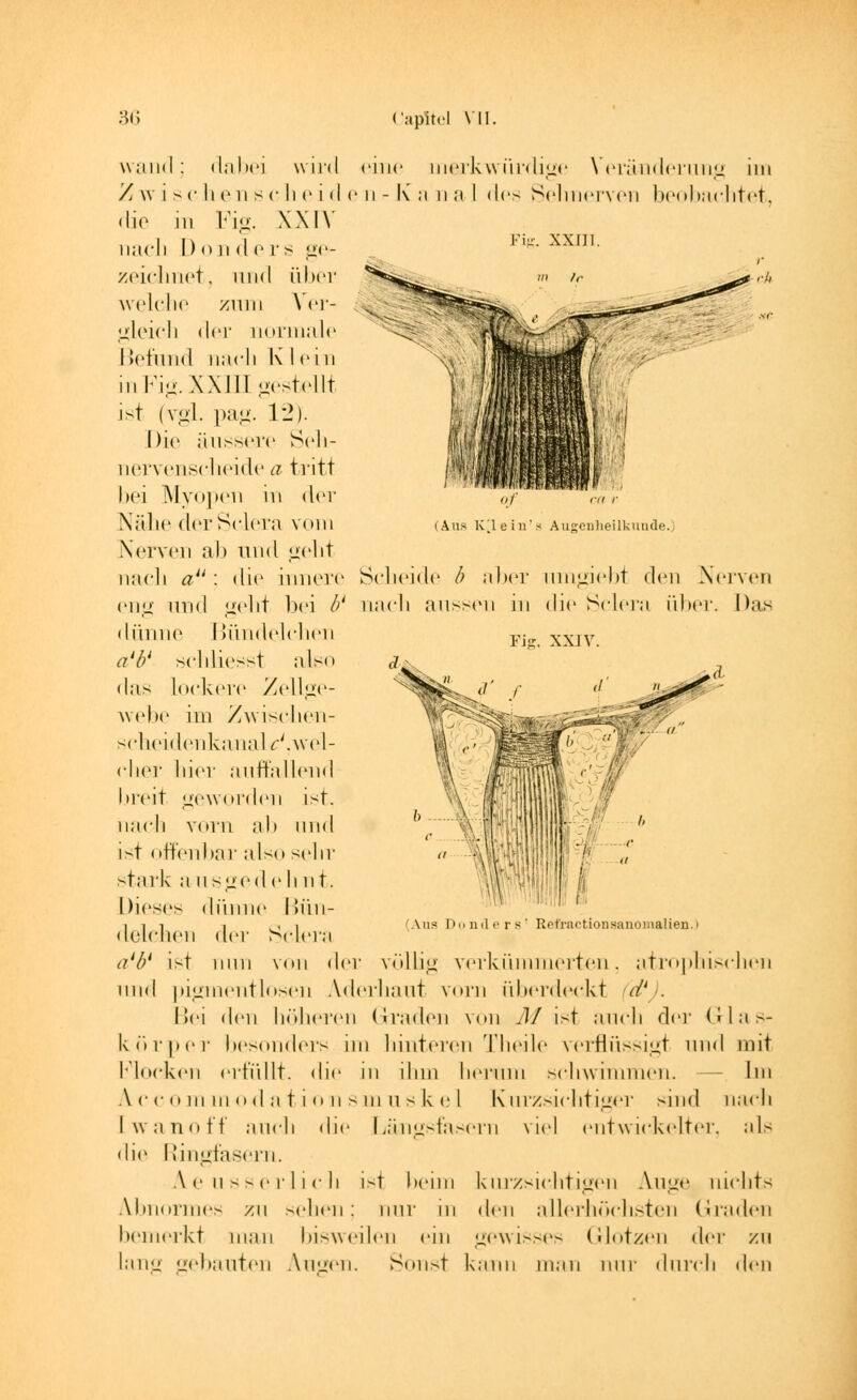 wand; dabei wird eine merkwürdige Veränderung im Zwis <• li c n s <• !i e i (I e n - K' ,-i n a I des Sehnerven beobachtet, die in Fig. XXIV nach Donders ee- Fig- xxm- zeichnet, und über ^»^ »> ><• welche zum Ver- gleich der normale Befund nach Klei n inFig. XXIII gestellt ist (vgl. pag. 12). Die äussere Seh- nervenscheide a tritt bei Myopen in der Nähe der Sclera vom Nerven ab und geht naeli a : die innere Scheide b aber nmgiebt den Nerven eng und geht bei b' nach aussen in die Sclera über. Das dünne Bündelchen oj m r (iiis K lein's Augenheilkunde.) Fie. XXIV. Ans Donders' Ret'rnctionsanomaüen. a'P schliesst also das lockere Zellge- webe im Zwisehen- scheidenkanalf'.wel- clier hier auffallend breit geworden ist. nach vorn ab und ist offenbar also sehr stark a n >^c(\ e li nt. Dieses dünne Bün- delchen der Sclera a'ö* ist min von der völlig verkümmerten, atrophischen und pigmentlosen Aderliaut vorn überdeckt (d'J. Bei den höheren Graden von M ist auch der Glas- körper besonders im hinteren Theile verflüssigt und mit Flocken erfüllt, die in ihm herum schwimmen. Im A c c o in in o d a t i o n s ni u s k e I Kurzsichtiger sind nach [wanoff auch die Längsfasern viel entwickelter, als die Ringfasem. Ä.eusserlich ist beün kurzsichtigen Auge nichts abnormes zu sehen; nur in den allerhöchsten Graden bemerkt man bisweilen ein gewisses (Motzen der zu lang gebauten Augen. Sonst kann man nur durch den