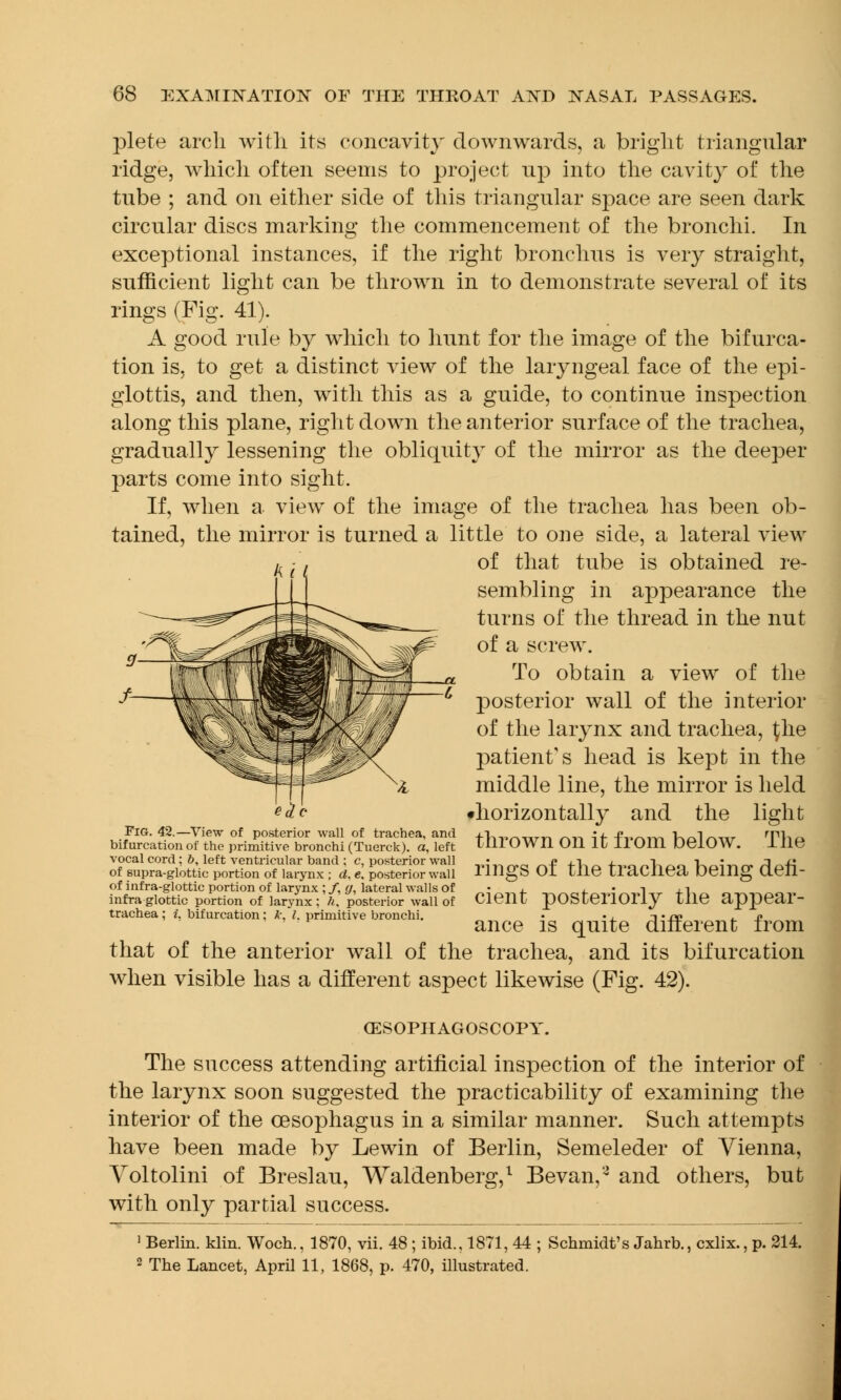 plete arch with its concavity downwards, a bright triangular ridge, which often seems to project up into the cavity of the tube ; and on either side of this triangular space are seen dark circular discs marking the commencement of the bronchi. In exceptional instances, if the right bronchus is very straight, sufficient light can be thrown in to demonstrate several of its rings (Fig. 41). A good rule by which to hunt for the image of the bifurca- tion is, to get a distinct view of the laryngeal face of the epi- glottis, and then, with this as a guide, to continue inspection along this plane, right down the anterior surface of the trachea, gradually lessening the obliquity of the mirror as the deeper parts come into sight. If, when a view of the image of the trachea has been ob- tained, the mirror is turned a little to one side, a lateral view of that tube is obtained re- sembling in appearance the turns of the thread in the nut of a screw. To obtain a view of the posterior wall of the interior of the larynx and trachea, ^he patient's head is kept in the middle line, the mirror is held 'horizontally and the light thrown on it from below. The rings of the trachea being defi- Kii Fig. 42.—View of posterior wall of trachea, and bifurcation of the primitive bronchi (Tuerck). a, left vocal cord; b, left ventricular band ; c, posterior wall of supra-glottic portion of larynx ; rf, e. posterior wall of infra-glottic portion of larynx ; /. g, lateral walls of infra glottic portion of larynx : h, posterior wall of trachea; i. bifurcation; A-, I. primitive bronchi. cient posteriorly the appear- ance is quite different from that of the anterior wall of the trachea, and its bifurcation when visible has a different aspect likewise (Fig. 42). OESOPHAGOSCOPY. The success attending artificial inspection of the interior of the larynx soon suggested the practicability of examining the interior of the oesophagus in a similar manner. Such attempts have been made by Lewin of Berlin, Semeleder of Vienna, Voltolini of Breslau, Waldenberg,1 Bevan,2 and others, but with only partial success. 1 Berlin, klin. Woch., 1870, vii. 48; ibid., 1871, 44 ; Schmidt's Jahrb., cxlix., p. 214. 2 The Lancet, April 11, 1868, p. 470, illustrated.