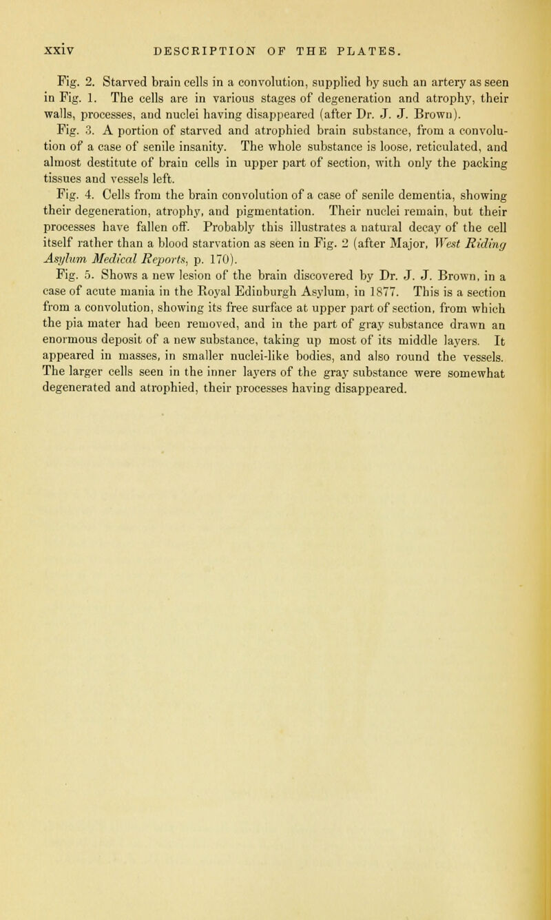 Fig. 2. Starved brain cells in a convolution, supplied by such an artery as seen in Fig. 1. The cells are in various stages of degeneration and atrophy, their walls, processes, and nuclei having disappeared (after Dr. J. J. Brown). Fig. 3. A portion of starved and atrophied brain substance, from a convolu- tion of a case of senile insanity. The whole substance is loose, reticulated, and almost destitute of brain cells in upper part of section, with only the packing tissues and vessels left. Fig. 4. Cells from the brain convolution of a case of senile dementia, showing their degeneration, atrophy, and pigmentation. Their nuclei remain, but their processes have fallen off. Probably this illustrates a natural decay of the cell itself rather than a blood starvation as seen in Fig. 2 (after Major, West Riding Asylum Medical Reports, p. 170). Fig. 5. Shows a new lesion of the brain discovered by Dr. J. J. Brown, in a case of acute mania in the Royal Edinburgh Asylum, in 1877. This is a section from a convolution, showing its free surface at upper part of section, from which the pia mater had been removed, and in the part of gray substance drawn an enormous deposit of a new substance, taking up most of its middle layers. It appeared in masses, in smaller nuclei-like bodies, and also round the vessels. The larger cells seen in the inner layers of the gray substance were somewhat degenerated and atrophied, their processes having disappeared.