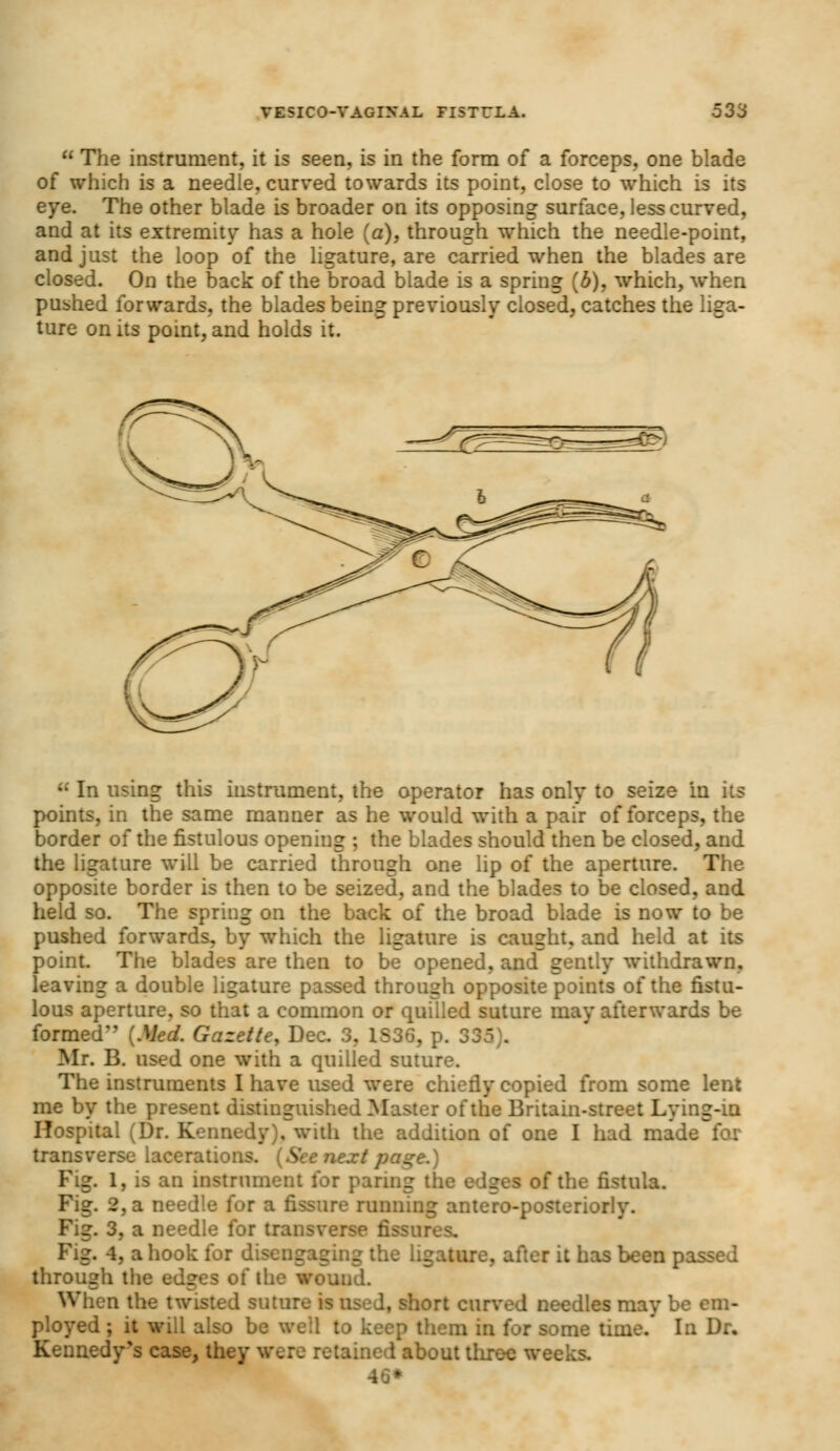  The instrument, it is seen, is in the form of a forceps, one blade of which is a needle, curved towards its point, close to which is its eye. The other blade is broader on its opposing surface, less curved, and at its extremity has a hole (a), through which the needle-point, and just the loop of the ligature, are carried when the blades are closed. On the back of the broad blade is a spring (b), which, when pushed forwards, the blades being previously closed, catches the liga- ture on its point, and holds it.  In using this instrument, the operator has only to seize in its points, in the same manner as he would with a pair of forceps, the border of the fistulous opening ; the blades should then be closed, and the ligature will be carried through one lip of the aperture. The opposite border is then to be seized, and the blades to be closed, and held so. The spring on the back of the broad blade is now to be pushed forwards, by which the ligature is caught, and held at its point. The blades are then to be opened, and gently withdrawn, leaving a double ligature passed through opposite points of the fistu- lous aperture, so that a common or quilled suture may afterwards be formed (Med. Gazette, Dec. 3, 1S36, p. 33 Mr. B. used one with a quilled suture. The instruments I have used were chiefly copied from some lent me by the present distinguished Master of the Britain-street Lying-in Hospital (Dr. Kennedy), with the addition of one I had made for transverse lacerations. (See next page.) Fig. 1, is an instrument for paring the edges of the fistula. Fig. 2, a needle for a fissure running antero-posteriorly. Fig. 3, a needle for transverse fissures. Fig. 4, a hook for disei: i :e ligature, after it has been passed through the edges of the wound. When the twisted suture is used, short curved needles may be em- ployed ; it will also be well to keep them in for some time. In Dr. Kennedy's case, they were retained about three weeks. *