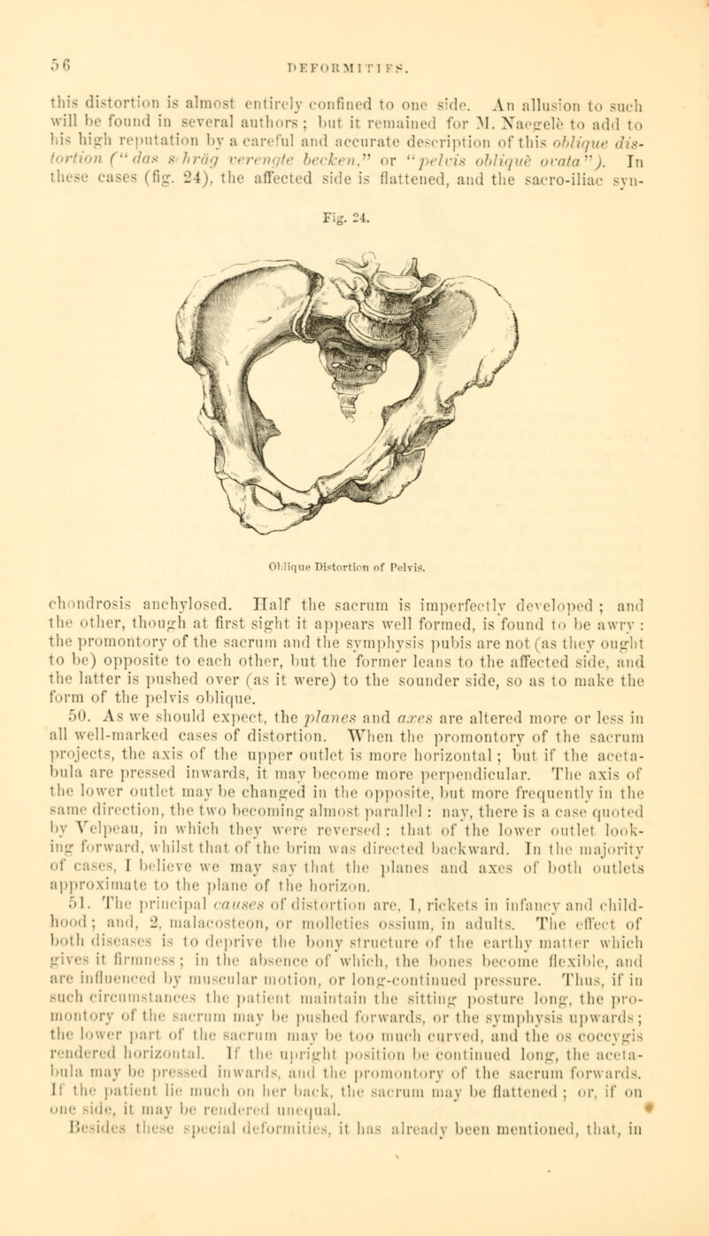 PEFoKMl Tl K: this distortion is almost entirely confined to one side. An allusion to such will lie found in several authors; but it remained for M. Naegele to add to his high reputation byacareful and accurate description of this oblique dis- tortion S'hrag m becken, or pelvis obliqud ouata). In these cases (fig. 24), the affected side is flattened, and the sacro-iliac syn- Fij ^^k* i Oblique Distortion of Pelvis. chondrosis anchylosed. Half the sacrum is imperfectly developed; and the other, though at first Bight it appears well formed, is found to lie awry : the promontory of the sacrum and the symphysis pubis are not (as they ought to be) opposite to each other, but the former leans to the affected side and the latter is push< d over < as it were) to the sounder side, so as to make the form of the pelvis oblique. 50. As we should expect, the planes and axes are altered more or less in all well-marked cases of distortion. When the promontory of the sacrum projects, the axis of the upper outlet is more horizontal; but if the aceta- bula are pressed inwards, it may become more perpendicular. The axis of the l<»wcr outlet maybe changed in the opposite, but more frequentlyin the same direction, the two becoming almost parallel : nay, there is a case quoted by Velpeau, in which they were reversed: that of the lower outlet look- ing forward, whilsl that of the brim was directed backward. In the majority of cases, 1 believe we may say that the planes and axes of both outlets approximate to the plane of the horizon. 51. The principal causes of distortion are. 1, rickets in infancy and child- hood; aid. 2, malacosteon, or molleties ossium, in adults. The effect of both diseases is to deprive the bony structure of the earthy matter which gives it firmness; in the absence of which, the bones become flexible, and arc inflii.■need by muscular motion, or long-continued pressure. Thus, if in Buch circumstances the patient maintain the Bitting posture long, the pro- montory of the Bacrum may be pushed forwards, or the symphysis upward-; the h.wcr pari of the Bacrum may be too much curved, and the os coccygis rendered horizontal. If the upright position he continued long, the aceta- luila may he pressed inwards, and the promontory of the sacrum forwards. If the patient lie much on her back, the Bacrum may lie flattened; or. if on one side, it may he rendered unequal. < Besides these special deformities, it bas already been mentioned, that, in