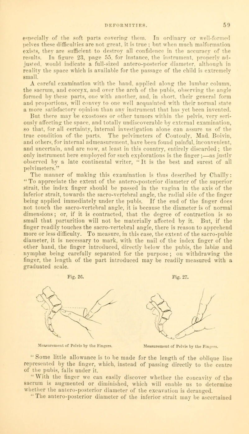 especially of the soft parts covering them. Tn ordinary or well-formed pelves these difficulties are not great, it is true ; but when much malformation exists, they arc sufficient to destroy all confidence in the accuracy of the results. In figure 23, page 55, for instance, the instrument, properly ad- justed, would indicate a fall-sized antero-posterior diameter, although in reality the space which is available for the passage of the child is extremely small. A careful examination with the hand, applied along the lumbar column, the sacrum, and coccyx, and over the arch of the pubis, observing the angle formed by these parts, one with another, and. in short, their general form and proportions, will convey to one well acquainted with their normal state a more satisfactory opinion than any instrument that has yet been invented. But there may he exostoses or other tumors within the pelvis, very seri- ously affecting the space, and totally uudiscoverable by external examination, so that, for all certainty, internal investigation alone can assure us of the true condition of the parts. The pelvimeters of Coutouly, Mad. Boivin, and others, for internal admeasurement, have been found painful, inconvenient, and uncertain, and are now, at least in this country, entirely discarded : the only instrument here employed for such explorations is the finder ;—as justly observed by a late continental writer, It is the best and surest of all pelvimeters. The manner of making this examination is thus described by Chailly: To appreciate the extent of the antero-posterior diameter of the superior strait, the index finger should be passed in the vagina in the axis of the inferior strait, towards the sacro-vertebral angle, the radial side of the finger being applied immediately under the pubis. If the end of the finger does not touch the sacro-vertebral angle, it is because the diameter is of normal dimensions ; or, if it is contracted, that the degree of contraction is so small that parturition will not be materially affected by it. But, if the finger readily touches the sacro-vertebral angle, there is reason to apprehend more or less difficulty. To measure, in this case, the extent of the sacro-pubic diameter, it is necessary to mark, with the nail of the index finger of the other hand, the finger introduced, directly below the pubis, the labia} and nymplue being carefully separated for the purpose; on withdrawing the finger, the length of the part introduced may be readily measured with a graduated scale. Fisr. 20. Fig. 27. Measurement of Pelvis by the Fingers. Measurement of Pelvis bv the Fin.  Some little allowance is to be made for the length of the oblique line represented by the finger, which, instead of passing directly to the centre of the pubis, falls under it. With the finger we can easily discover whether the concavity of the sacrum is augmented or diminished, which will enable us to determine whether the antero-posterior diameter of the excavation is deranged. The antero-posterior diameter of the inferior strait may he ascertained