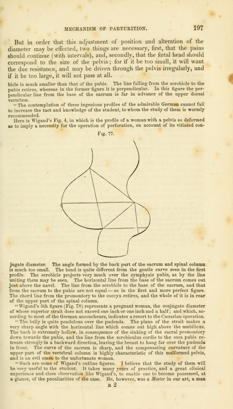 But in order that this adjustment of position and alteration of the diameter may be effected, two things are necessary, first, that the pains should continue (with intervals), and, secondly, that the foetal head should correspond to the size of the pelvis ; for if it be too small, it will want the due resistance, and may be driven through the pelvis irregularly, and if it be too large, it will not pass at all. bicle is much smaller than that of the pubis. The line falling from the scrobicle to the pubis retires, whereas in the former figure it is perpendicular. In this figure the per- pendicular line from the base of the sacrum is far in advance of the upper dorsal vertebrae.  The contemplation of these ingenious profiles of the admirable German cannot fail to increase the tact and knowledge of the student, to whom the study of them is warmly recommended. Here is Wigand's Fig. 4, in which is the profile of a woman with a pelvis so deformed as to imply a necessity for the operation of perforation, on account of its vitiated con- Fig. 77. jugate diameter. The angle formed by the back part of the sacrum and spinal column is much too small. The bend is quite different from the gentle curve seen in the first profile. The scrobicle projects very much over the symphysis pubis, as by the line uniting them may be seen. The horizontal line from the base of the sacrum comes out just above the navel. The line from the scrobicle to the base of the sacrum, and that from the sacrum to the pubis are not equal—as in the first and more perfect figure. The chord line from the promontory to the coccyx retires, and the whole of it is in rear of the upper part of the spinal column. Wigand's 5th figure (Fig. 78) represents a pregnant woman, the conjugate diameter of whose superior strait does not exceed one inch or one inch and a half; and which, ac- cording to most of the German accoucheurs, indicates a resort to the Caesarian operation.  The belly is quite pendulous over the pudenda. The plane of the strait makes a very sharp angle with the horizontal line which comes out high above the umbilicus. The back is extremely hollow, in consequence of the sinking of the sacral promontory down towards the pubis, and the line from the scrobiculus cordis to the ossa pubis re- treats strongly in a backward direction, leaving the breast to hang far over the pudenda in front. The curve of the sacrum is sharp, and the compensating curvature of the upper part of the vertebral column is highly characteristic of this malformed pelvis, and is an evil omen to the unfortunate woman.  Such are some of Wigand's outline figures. I believe that the study of them will be very useful to the student. It takes many years of practice, and a great clinical experience and close observation like Wigand's, to enable one to become possessed, at a glance, of the peculiarities of the case. He, however, was a Master in our art, a man e2