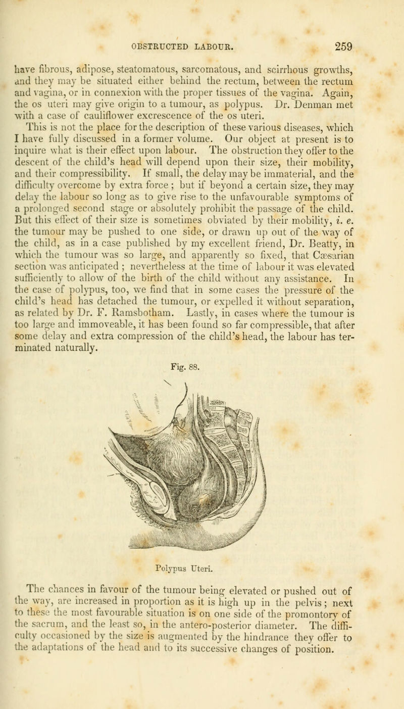 have fibrous, adipose, steatomatous, sarcomatous, and scirrhous growths, and they may be situated either behind the rectum, between the rectum and vagina, or in connexion with the proper tissues of the vagina. Again, the os uteri may give origin to a tumour, as polypus. Dr. Denman met with a case of cauliflower excrescence of the os uteri. This is not the place for the description of these various diseases, which I have fully discussed in a former volume. Our object at present is to inquire what is their effect upon labour. The obstruction they offer to the descent of the child's head will depend upon their size, their mobility, and their compressibility. If small, the delay may be immaterial, and the difficulty overcome by extra force ; but if beyond a certain size, they may delay the labour so long as to give rise to the unfavourable symptoms of a prolonged second stage or absolutely prohibit the passage of the child. But this effect of their size is sometimes obviated by their mobility, i. e. the tumour may be pushed to one side, or drawn up out of the way of the child, as in a case published by my excellent friend, Dr. Beatty, in which the tumour was so large, and apparently so fixed, that Caesarian section was anticipated ; nevertheless at the time of labour it was elevated sufficiently to allow of the birth of the child without any assistance. In the case of polypus, too, we find that in some cases the pressure of the child's head has detached the tumour, or expelled it without separation, as related by Dr. F. Ramsbotham. Lastly, in cases where the tumour is too large and immoveable, it has been found so far compressible, that after some delay and extra compression of the child's head, the labour has ter- minated naturally. Fig. 88. Polypus Uteri. The chances in favour of the tumour being elevated or pushed out of the way, are increased in proportion as it is high up in the pelvis; next to these the most favourable situation is on one side of the promontory of the sacrum, and the least so, in the antero-posterior diameter. The diffi- culty occasioned by the size is augmented by the hindrance they offer to the adaptations of the head and to its successive changes of position.