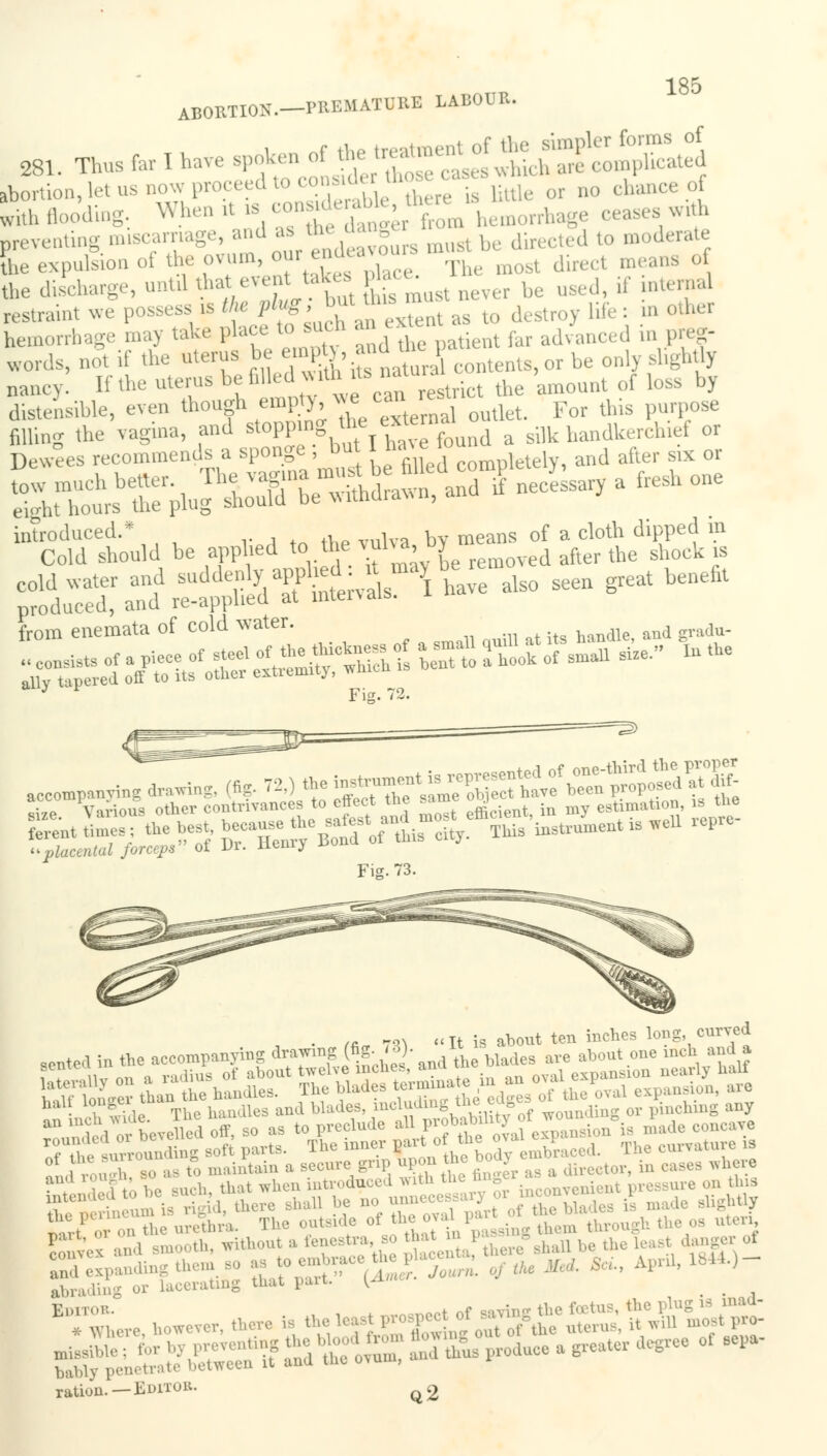 1 9>£\ ABORTION.—PREMATURE LABOUR. Portion,let us now proceed oconsiJ ».,.-; ' Me or „„ chance o with flooding. When .t is ~ {,',;., from hemorrhage ceases wu* preventing miscarriage, and as thedag ^^ t0 moderate Sm expulsion of the ovum>, our adav° diRvl ?eans of the discharge, until tin, t evtakes ^ be uged ,, ,, i restraint we Possef,^'tito such an extent as to destroy life: m other hemorrhage may fake place to sucn an fer adyanced m preg. words, not if the uterus he em^r, andmej be Qnl llghfly nancy. If the uterus b<s filled uilmis nat amount rf ]oss by distcnsihle, even though empty, ™ can re* For ^ introduced.* , b means 0f a cloth dipped in Cold should be applied to the vulva, i y after ^ sbock cold water and suddenly apptd; 'J™* * ^ benefil produced, and re-apphed at intervals. from enemata of cold water. and Ju. Fig. 72. Fig. 73. , • f*„ TO It is about ten inches long curved Bented in the accompanying ^TOgXteW)- Wades are about one inch anda S5 The handles and blades, ^^toB »J-*f5 wounding or pinchmg any SSvbedx^=gffl£^: 'i ration.—Editor. q2