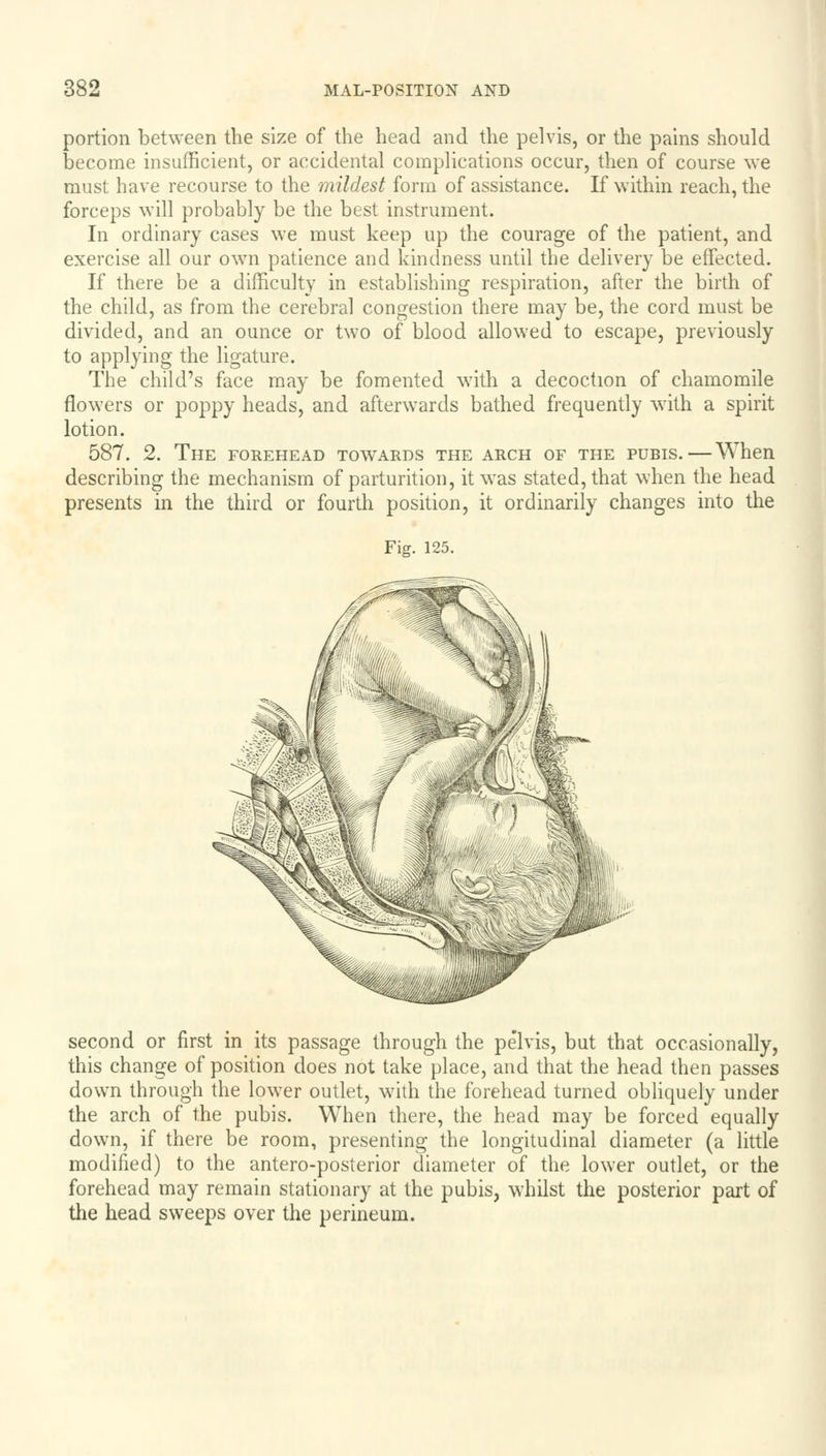 portion between the size of the head and the pelvis, or the pains should become insufficient, or accidental complications occur, then of course we must have recourse to the mildest form of assistance. If within reach, the forceps will probably be the best instrument. In ordinary cases we must keep up the courage of the patient, and exercise all our own patience and kindness until the delivery be effected. If there be a difficulty in establishing respiration, after the birth of the child, as from the cerebral congestion there may be, the cord must be divided, and an ounce or two of blood allowed to escape, previously to applying the ligature. The child's face may be fomented with a decoction of chamomile flowers or poppy heads, and afterwards bathed frequently with a spirit lotion. 587. 2. The forehead towards the arch of the pubis.—When describing the mechanism of parturition, it was stated, that when the head presents in the third or fourth position, it ordinarily changes into the Fig. 125. second or first in its passage through the pelvis, but that occasionally, this change of position does not take place, and that the head then passes down through the lower outlet, with the forehead turned obliquely under the arch of the pubis. When there, the head may be forced equally down, if there be room, presenting the longitudinal diameter (a little modified) to the antero-posterior diameter of the lower outlet, or the forehead may remain stationary at the pubis, whilst the posterior part of the head sweeps over the perineum.