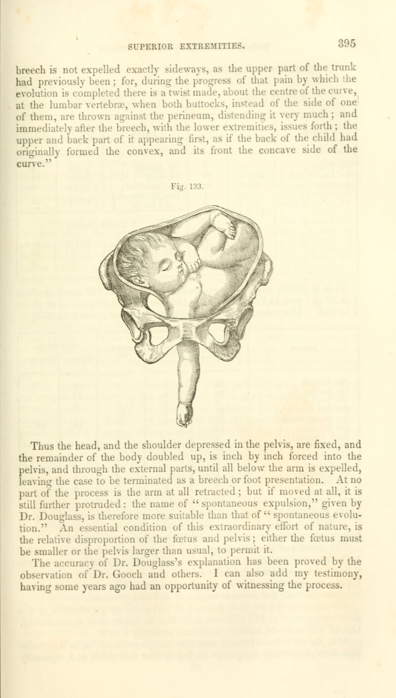 breech is not expelled exactly sideways, as the upper part of the trunk had previously been ; for, during th< 3 of that pain by whi< evolution is completed there is a twis ma le, about the centreof the cuive, at the lumbar vertebrae, when both buttocks, instead of the side of one of them, are throv. the perineum, distending it very much; and immediately after the breech, with the lower extrem forth ; the upper and Lack part of it appearing first, as if the back of the child had originally forme J the convex, and its front the concave side of the Thus the head, and the shoulder depressed in the pelvis, are fixed, and the remainder of the body doubled up, is inch by inch forced into the pelvis, and through the external parts, until all below the arm is expelled, leaving the case to be terminated as a breech or foot presentation. At no part of the process is the arm at all retracted ; but if moved at all, it is still further protruded: the name of  spontaneous expulsion, given by Dr. Douglass, is therefore more suitable than that of  spontaneous evolu- tion. An essential condition of this extraordinary effort of nature, is the relative disproportion of the foetus and pelvis; either the fetus must be smaller or the pelvis larger than usual, to permit it. The accuracy of Dr. Douglass's explanation has been proved by the observation of*Dr. Gooch and others. I can also add my testimony, having some years ago had an opportunity of witnessing the process.