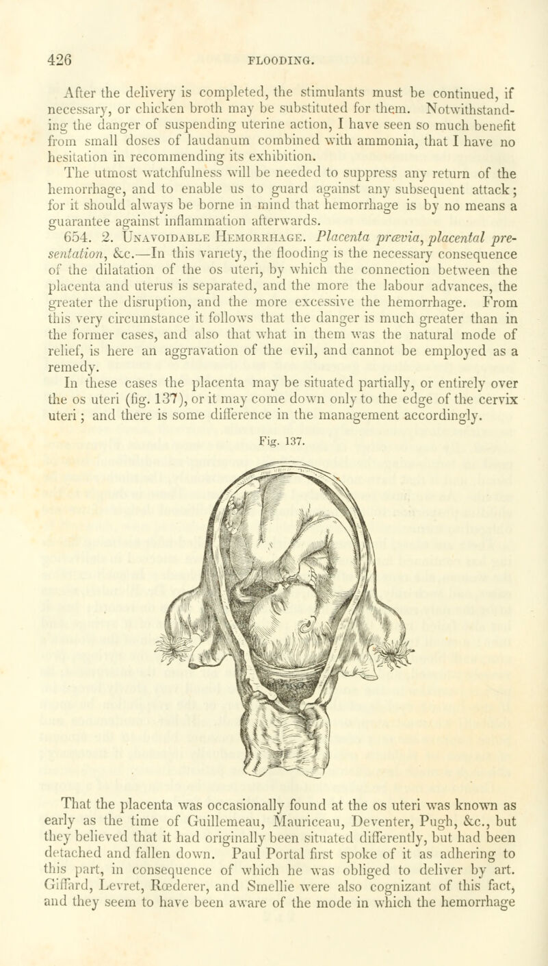 After the delivery is completed, the stimulants must be continued, if necessary, or chicken broth may be substituted for them. Notwithstand- ing the danger of suspending uterine action, I have seen so much benefit from small doses of laudanum combined with ammonia, that I have no hesitation in recommending its exhibition. The utmost watchfulness will be needed to suppress any return of the hemorrhage, and to enable us to guard against any subsequent attack; for it should always be borne in mind that hemorrhage is by no means a guarantee against inflammation afterwards. 654. 2. Unavoidable Hemorrhage. Placenta prcevia, placental pre- sentation, &c.—In this variety, the flooding is the necessary consequence of the dilatation of the os uteri, by which the connection between the placenta and uterus is separated, and the more the labour advances, the greater the disruption, and the more excessive the hemorrhage. From this very circumstance it follows that the danger is much greater than in the former cases, and also that what in them was the natural mode of relief, is here an aggravation of the evil, and cannot be employed as a remedy. In these cases the placenta may be situated partially, or entirely over the os uteri (fig. 137), or it may come down only to the edge of the cervix uteri; and there is some difference in the management accordingly. F\s. 137. That the placenta was occasionally found at the os uteri wras known as early as the time of Guillemeau, Mauriceau, Deventer, Pugh, &c, but they believed that it had originally been situated differently, but had been detached and fallen down. Paul Portal first spoke of it as adhering to this part, in consequence of which he was obliged to deliver by art. Giffard, Levret, Roederer, and Smellie were also cognizant of this fact, and they seem to have been aware of the mode in which the hemorrhage
