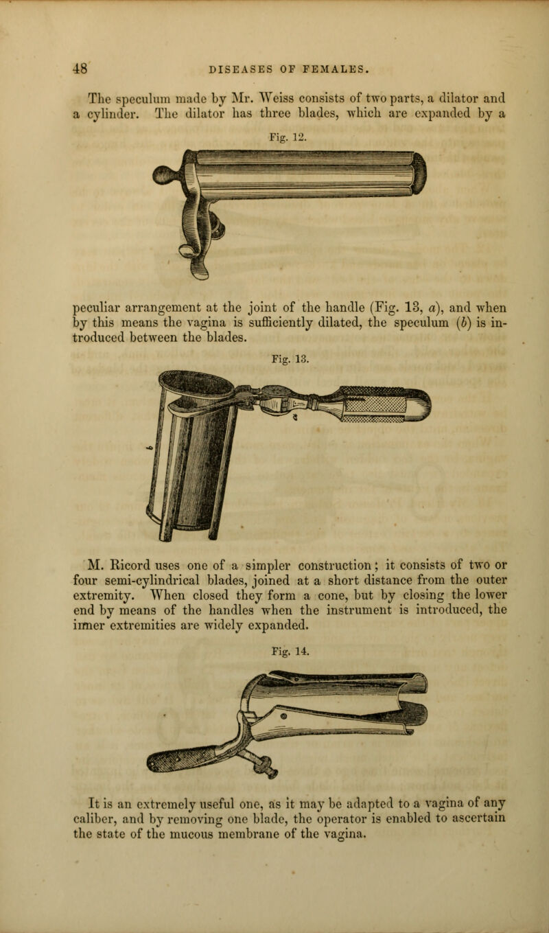 The speculum made by Mr. Weiss consists of two parts, a dilator and a cylinder. The dilator has three blades, which are expanded by a Fig. 12. peculiar arrangement at the joint of the handle (Fig. 13, a), and when by this means the vagina is sufficiently dilated, the speculum (b) is in- troduced between the blades. Fig. 13. M. Ricord uses one of a simpler construction; it consists of two or four semi-cylindrical blades, joined at a short distance from the outer extremity. When closed they form a cone, but by closing the lower end by means of the handles when the instrument is introduced, the inner extremities are widely expanded. Fig. 14. It is an extremely useful one, as it may be adapted to a vagina of any caliber, and by removing one blade, the operator is enabled to ascertain the state of the mucous membrane of the vagina.