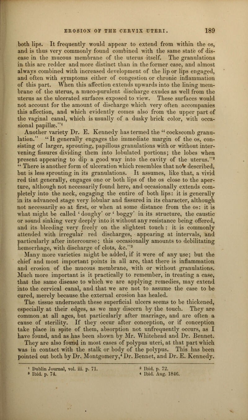 both lips. It frequently would appear to extend from within the os, and is thus very commonly found combined with the same state of dis- ease in the mucous membrane of the uterus itself. The granulations in this are redder and more distinct than in the former case, and almost always combined with increased development of the lip or lips engaged, and often with symptoms either of congestion or chronic inflammation of this part. When this affection extends upwards into the lining mem- brane of the uterus, a muco-purulent discharge exudes as well from the uterus as the ulcerated surfaces exposed to view. These surfaces would not account for the amount of discharge which very often accompanies this affection, and which evidently comes also from the upper part of the vaginal canal, which is usually of a dusky brick color, with occa- sional papillae.1 Another variety Dr. E. Kennedy has termed the  cockscomb granu- lation. It generally engages the immediate margin of the os, con- sisting of larger, sprouting, papillous granulations with or without inter- vening fissures dividing them into lobulated portions; the lobes when present appearing to dip a good way into the cavity of the uterus.2  There is another form of ulceration which resembles that now described, but is less sprouting in its granulations. It assumes, like that, a vivid red tint generally, engages one or both lips of the os close to the aper- ture, although not necessarily found here, and occasionally extends com- pletely into the neck, engaging the entire of both lips: it is generally in its advanced stage very lobular and fissured in its character, although not necessarily so at first, or when at some distance from the os: it is what might be called * doughy' or ' boggy' in its structure, the caustic or sound sinking very deeply into it without any resistance being offered, and its bleeding very freely on the slightest touch : it is commonly attended with irregular red discharges, appearing at intervals, and particularly after intercourse; this occasionally amounts to debilitating hemorrhage, with discharge of clots, &c.3 Many more varieties might be added, if it were of any use; but the chief and most important points in all are, that there is inflammation and erosion of the mucous membrane, with or without granulations. Much more important is it practically to remember, in treating a case, that the same disease to which we are applying remedies, may extend into the cervical canal, and that we are not to assume the case to be cured, merely because the external erosion has healed. The tissue underneath these superficial ulcers seems to be thickened, especially at their edges, as we may discern by the touch. They are common at all ages, but particularly after marriage, and are often a cause of sterility. If they occur after conception, or if conception take place in spite of them, absorption not unfrequently occurs, as I have found, and as has been shown by Mr. Whitehead and Dr. Bennet. They are also found in most cases of polypus uteri, at that part which was in contact with the stalk or body of the polypus. This has been pointed out both by Dr. Montgomery,4 Dr. Bennet, and Dr. E. Kennedy. 1 Dublin Journal, vol. iii. p. 71. 2 Ibid. p. 72. 3 Ibid. p. 74. « Ibid. Aug. 184G.