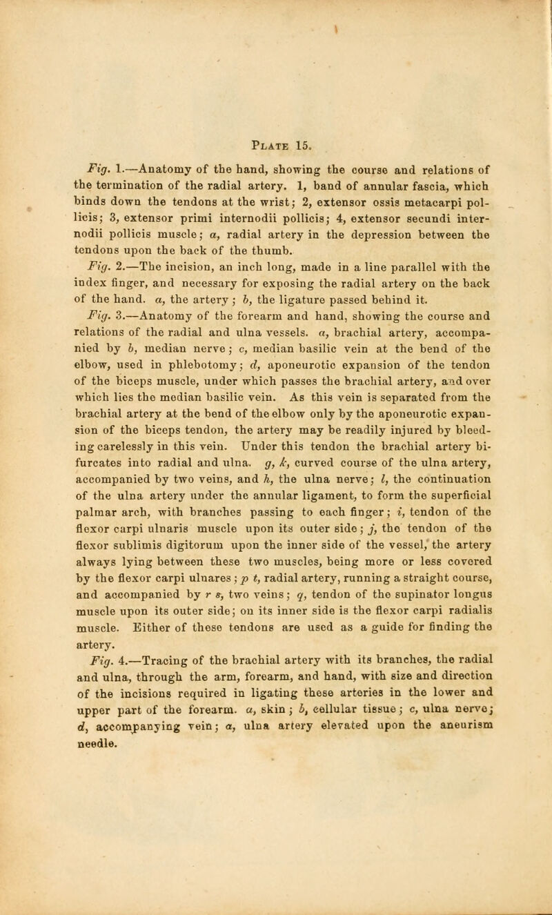 Fig. 1.—Anatomy of the hand, showing the course and relations of the termination of the radial artery. 1, band of annular fascia, which binds down the tendons at the wrist; 2, extensor ossis metaearpi pol- licis; 3, extensor primi internodii pollicis; 4, extensor secundi inter- nodii pollicis muscle; a, radial artery in the depression between the tendons upon the back of the thumb. Fig. 2.—The incision, an inch long, made in a line parallel with the index finger, and necessary for exposing the radial artery on the back of the hand, a, the artery ; b, the ligature passed behind it. Fig. 3.—Anatomy of the forearm and hand, showing the course and relations of the radial and ulna vessels, a, brachial artery, accompa- nied by b, median nerve; c, median basilic vein at the bend of the elbow, used in phlebotomy; d, aponeurotic expansion of the tendon of the biceps muscle, under which passes the brachial artery, and over which lies the modian basilic vein. As this vein is separated from the brachial artery at the bend of the elbow only by the aponeurotic expan- sion of the biceps tendon, the artery may be readily injured by bleed- ing carelessly in this vein. Under this tendon the brachial artery bi- furcates into radial and ulna, g, k, curved course of the ulna artery, accompanied by two veins, and h, the ulna nerve; I, the continuation of the ulna artery under the annular ligament, to form the superficial palmar arch, with branches passing to each finger; i, tendon of the floxor carpi ulnaris muscle upon its outer side; j, the tendon of the flexor sublimis digitorum upon the inner side of the vessel, the artery always lying between these two muscles, being more or less covered by the flexor carpi ulnares ; p t, radial artery, running a straight course, and accompanied by r », two veins; q, tendon of the supinator longus muscle upon its outer side; on its inner side is the flexor carpi radialis muscle. Either of these tendons are used as a guide for finding the artery. Fig. 4.—Tracing of the brachial artery with its branches, the radial and ulna, through the arm, forearm, and hand, with size and direction of the incisions required in ligating these arteries in the lower and upper part of the forearm, a, skin; b, cellular tissue; c, ulna nervo; d, accompanying vein; a, ulna artery elevated upon the aneurism needle.