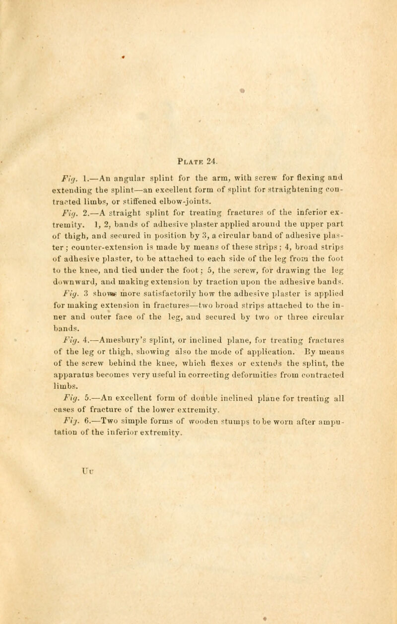 Fig. 1.—An angular splint for the arm, with screw for flexing and extending the splint—an excellent form of splint for straightening con- tracted limbs, or stiffened elbow-joints. Fig. 2.—A straight splint for treating fractures of the inferior ex- tremity. 1, 2, bands of adhesive plaster applied around the upper part of thigh, and secured in position by 3, a circular band of adhesive plas- ter ; counter-extension is made by means of these strips; 4, broad strips of adhesive plaster, to be attached to each side of the leg from the foot to the knee, and tied under the foot; 5, the screw, for drawing the leg downward, and making extension by traction upon the adhesive bands. Fig. 3 show more satisfactorily how the adhesive plaster is applied for making extension in fractures—two broad strips attached to the in- ner and outer face of the leg, and secured by two or three circular bands. Fig. 4.—Aniesbury's splint, or inclined plane, for treating fractures of the leg or thigh, showing also the mode of application. By ineaus of the screw behind the knee, which flexes or extends the splint, the apparatus becomes very useful in correcting deformities from contracted limbs. Fig. 5.—An excellent form of double inclined plane for treating all eases of fracture of the lower extremity. Fij. 6.—Two simple forms of wooden stumps to be worn after ampu- tation of the inferior extremity. Yv
