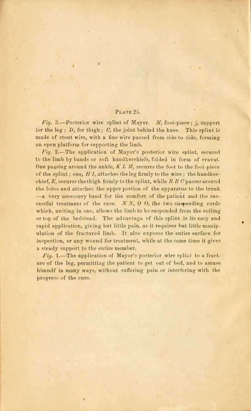 Fig. 3.—Posterior wire splint of Mayor. M, foot-piece; j, support for the leg ; D, for thigh ; C, the joint behind the knee. This splint is made of stout wire, with a fine wire passed from side to side, forming an open platform for supporting the limb. Fig. 2.—The application of Mayor's posterior wire splint, secured to the limb by bands or soft handkerchiefs, folded in form of cravat. One parsing around the ankle, K L M, secures the foot to the foot-piece of the splint: one, HI, attaches the leg firmly to the wire ; the handker- chief, E, secures the thigh firmly to the splint, while B B C passes around the loins and attaches the upper portion of the apparatus to the trunk —a very necessary band for the comfort of the patient and the suc- cessful treatment of the case. N N, 0 0, the two suspending cords which, uniting in one, allows the limb to be suspended from the ceiling or top of the bedstead. The advantage of this splint is its easy and rapid application, giving but little pain, as it requires but little manip- ulation of the fractured limb. It also exposes the entire surface for inspection, or any wound for treatment, while at the same time it gives a steady support to the entire member. Fig. 1.—The application of Mayor's posterior wire spliiit to a fract- ure of the leg, permitting the patient to get out of bed, and to amuse himself in many ways, without suffering pain or interfering with the progress of the cure.