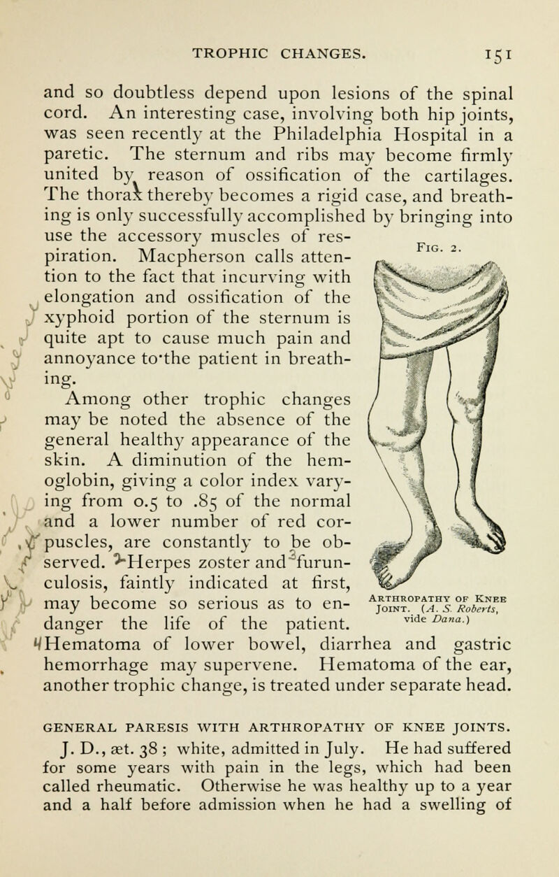 JS1 Fig. 2. and so doubtless depend upon lesions of the spinal cord. An interesting case, involving both hip joints, was seen recently at the Philadelphia Hospital in a paretic. The sternum and ribs may become firmly united by reason of ossification of the cartilages. The thorax thereby becomes a rigid case, and breath- ing is only successfully accomplished by bringing into use the accessory muscles of res- piration. Macpherson calls atten- tion to the fact that incurving with /elongation and ossification of the xyphoid portion of the sternum is quite apt to cause much pain and annoyance to'the patient in breath- ing. Among other trophic changes may be noted the absence of the general healthy appearance of the skin. A diminution of the hem- oglobin, giving a color index vary- ing from 0.5 to .85 of the normal and a lower number of red cor- puscles, are constantly to be ob- served. -^Herpes zoster andrurun- culosis, faintly indicated at first, may become so serious as to en- danger the life of the patient. 4 Hematoma of lower bowel, diarrhea and gastric hemorrhage may supervene. Hematoma of the ear, another trophic change, is treated under separate head. Arthropathy of Knee Joint. (A. S. Roberts, vide Dana.) GENERAL PARESIS WITH ARTHROPATHY OF KNEE JOINTS. J. D.,£et. 38; white, admitted in July. He had suffered for some years with pain in the legs, which had been called rheumatic. Otherwise he was healthy up to a year and a half before admission when he had a swelling of