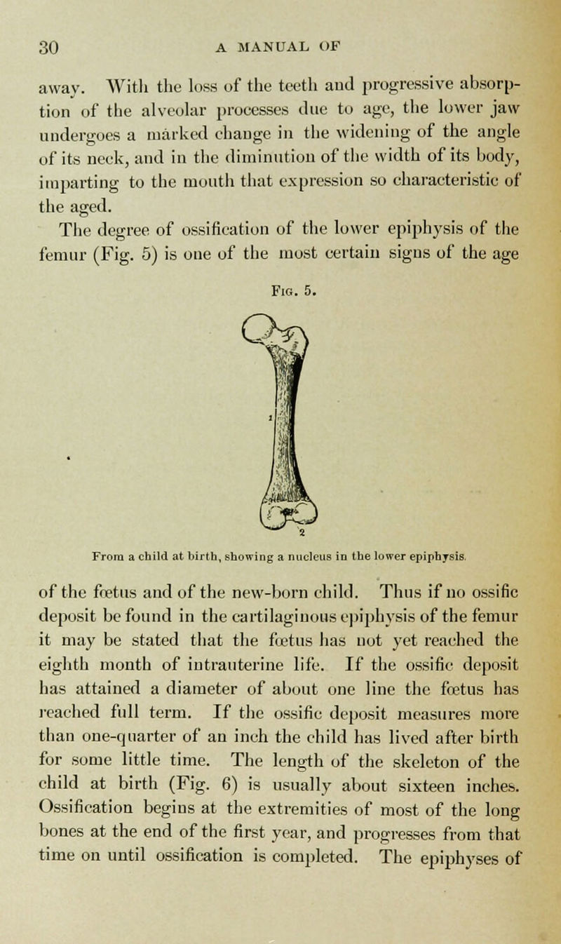 away. With the loss of the teeth and progressive absorp- tion of the alveolar processes due to age, the lower jaw undergoes a marked change in the widening of the angle of its neck, and in the diminution of the width of its body, imparting to the mouth that expression so characteristic of the aged. The degree of ossification of the lower epiphysis of the femur (Fig. 5) is oue of the most certain signs of the age Fig. 5. From a child at birth, showing a nucleus in the lower epiphysis. of the fnetus and of the new-born child. Thus if no ossific deposit be found in the cartilaginous epiphysis of the femur it may be stated that the foetus has not yet reached the eighth month of intrauterine life. If the ossific deposit has attained a diameter of about one line the foetus has reached full term. If the ossific deposit measures more than one-cpiarter of an inch the child has lived after birth for some little time. The length of the skeleton of the child at birth (Fig. 6) is usually about sixteen inches. Ossification begins at the extremities of most of the long bones at the end of the first year, and progresses from that time on until ossification is completed. The epiphyses of