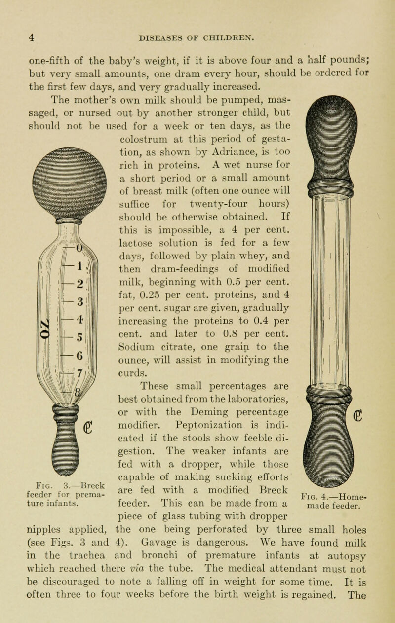 c flti one-fifth of the baby's weight, if it is above four and a half pounds; but very small amounts, one dram every hour, should be ordered for the first few days, and very gradually increased. The mother's own milk should be pumped, mas- saged, or nursed out by another stronger child, but should not be used for a week or ten clays, as the colostrum at this period of gesta- tion, as shown by Adriance, is too rich in proteins. A wet nurse for a short period or a small amount of breast milk (often one ounce will suffice for twenty-four hours) should be otherwise obtained. If this is impossible, a 4 per cent, lactose solution is fed for a few days, followed by plain whey, and then dram-feedings of modified milk, beginning with 0.5 per cent, fat, 0.25 per cent, proteins, and 4 per cent, sugar are given, gradually increasing the proteins to 0.4 per cent, and later to 0.8 per cent. Sodium citrate, one grain to the ounce, will assist in modifying the curds. These small percentages are best obtained from the laboratories, or with the Deming percentage modifier. Peptonization is indi- cated if the stools show feeble di- gestion. The weaker infants are fed with a dropper, while those capable of making sucking efforts are fed with a modified Breck feeder. This can be made from a piece of glass tubing with dropper the one being perforated by three small holes 4). Gavage is dangerous. We have found milk and bronchi of premature infants at autopsy The medical attendant must not It is The Fig. 3.—Breck feeder for prema- ture infants. Fig. 4.—Home- made feeder. nipples applied, (see Figs. 3 and in the trachea which reached there via the tube be discouraged to note a falling off in weight for some time. often three to four weeks before the birth weight is regained