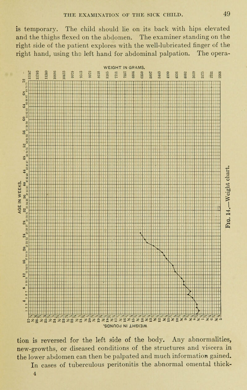 is temporary. The child should lie on its back with hips elevated and the thighs flexed on the abdomen. The examiner standing on the right side of the patient explores with the well-lubricated finger of the right hand, using ths left hand for abdominal palpation. The opera- WEIQHT IN GRAMS, a S § 1 ,'»iT J „t.- „T-i. --»T -i»-T -|,T ~-.U-. --„-. -:\-r -.\-r --.\„- -~.I,-,--!,-. -r|„-,-t|,- ---I-,- --t|^ S]s a-S! x|w a •SaNHOd Nl 1HOI3M tion is reversed for the left side of the body. Any abnormalities, new-growths, or diseased conditions of the structures and viscera in the lower abdomen can then be palpated and much information gained. In cases of tuberculous peritonitis the abnormal omental thick- 4