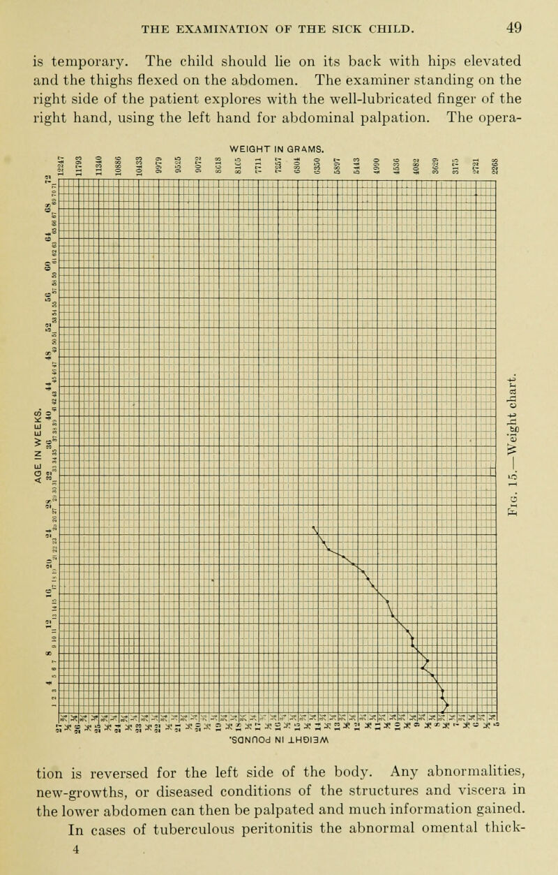 is temporary. The child should lie on its back with hips elevated and the thighs flexed on the abdomen. The examiner standing on the right side of the patient explores with the well-lubricated finger of the right hand, using the left hand for abdominal palpation. The opera- WEIQHT IN QRAMS. z 111 12247 11793 11310 I088G 10133 9979 S 23 8 HS,S°aS°'&OISia «-co : . , .i . j ||i ji Mil II hi | I o i I i i .. • 1 ' l_l '_U 1  „ 1 III JJ 1 j -: _ _ T- _±_i i+, , * r •• I . - ..- jTj |  X ° B s  --:: 2 j=  , Z III S L_ n T, i * 1 ! Mi r r e , i ! i i i I ii i i M Hill 11 : 1 1 II 1 TT Mill 1 i , t  * i I r i _±tt i is 1 1 -  \ '»■::: ±:::_: V s t \ ; t^ + l>- 1 > ^* \ L.^::::::Sffifflfi: ^ Nh1 \ r\ - '.,..-, \ \ - I V I' ■ 7 . <B ^s^ \ v 1 1 i p. T itiXit^* «tj-- it-* it -tit ^ M ** Si ■*• si ■*■ N •** *j ^ *i ^u •- ^ \\ _- ;;; „t it -. - -t -:- _t „t -t it _™ it' x n~ -~ it X £ Xit. J! £ - it X lit X - * » 35 « -a bO •SaNOOd Nl J.HOI3M tion is reversed for the left side of the body. Any abnormalities, new-growths, or diseased conditions of the structures and viscera in the lower abdomen can then be palpated and much information gained. In cases of tuberculous peritonitis the abnormal omental thick- 4