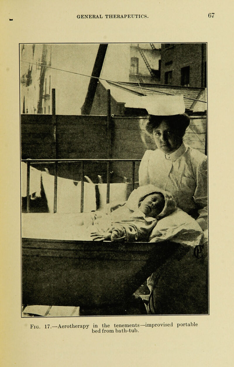 Fig. 17.—Aerotherapy in the tenements—improvised portable bed from bath-tub.