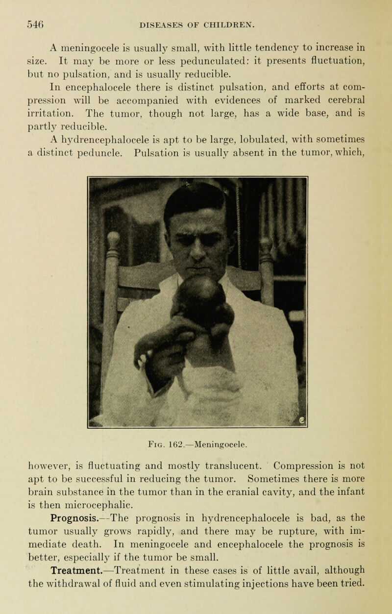 A meningocele is usually small, with little tendency to increase in size. It may be more or less pedunculated: it presents fluctuation, but no pulsation, and is usually reducible. In encephalocele there is distinct pulsation, and efforts at com- pression will be accompanied with evidences of marked cerebral irritation. The tumor, though not large, has a wide base, and is partly reducible. A hydrencephalocele is apt to be large, lobulated, with sometimes a distinct peduncle. Pulsation is usually absent in the tumor, which, Fig. 162.—Meningocele. however, is fluctuating and mostly translucent. Compression is not apt to be successful in reducing the tumor. Sometimes there is more brain substance in the tumor than in the cranial cavity, and the infant is then microcephalic. Prognosis.—The prognosis in hydrencephalocele is bad, as the tumor usually grows rapidly, and there may be rupture, with im- mediate death. In meningocele and encephalocele the prognosis is better, especially if the tumor be small. Treatment.—Treatment in these cases is of little avail, although the withdrawal of fluid and even stimulating injections have been tried.