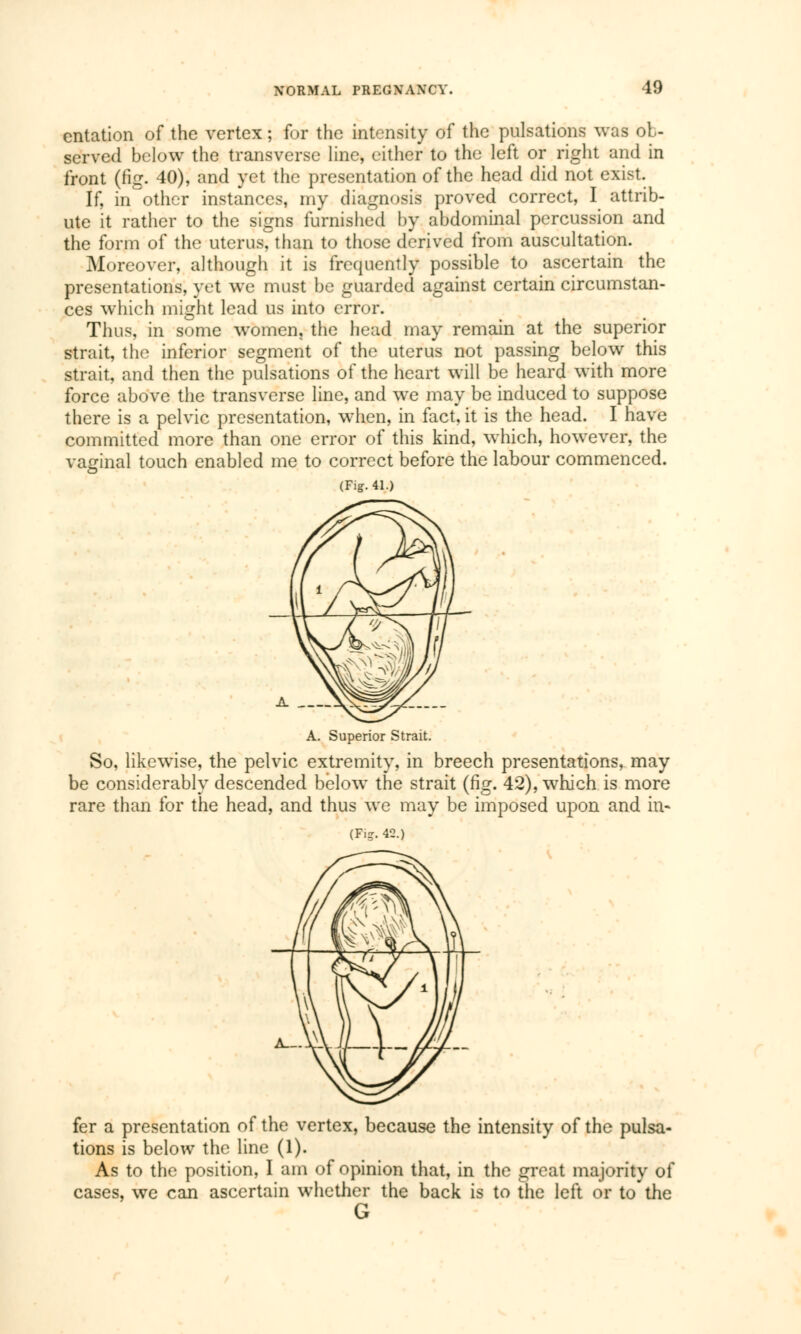 cntation of the vertex ; for the intensity of the pulsations was ob- served below the transverse line, either to the left or right and in front (fig. 40), and yet the presentation of the head did not exist. If, in other instances, my diagnosis proved correct, I attrib- ute it rather to the signs furnished by abdominal percussion and the form of the uterus, than to those derived from auscultation. Moreover, although it is frequently possible to ascertain the presentations, yet we must be guarded against certain circumstan- ces which might lead us into error. Thus, in some women, the head may remain at the superior strait, the inferior segment of the uterus not passing below this strait, and then the pulsations of the heart will be heard with more force above the transverse line, and we may be induced to suppose there is a pelvic presentation, when, in fact, it is the head. I have committed more than one error of this kind, which, however, the vaginal touch enabled me to correct before the labour commenced. (Fig. 41.) A. Superior Strait. So, likewise, the pelvic extremity, in breech presentations, may be considerably descended below the strait (fig. 42), which is more rare than for the head, and thus we may be imposed upon and in- (Fi?. 42.) fer a presentation of the vertex, because the intensity of the pulsa- tions is below the line (1). As to the position, I am of opinion that, in the great majority of cases, we can ascertain whether the back is to the left or to the G